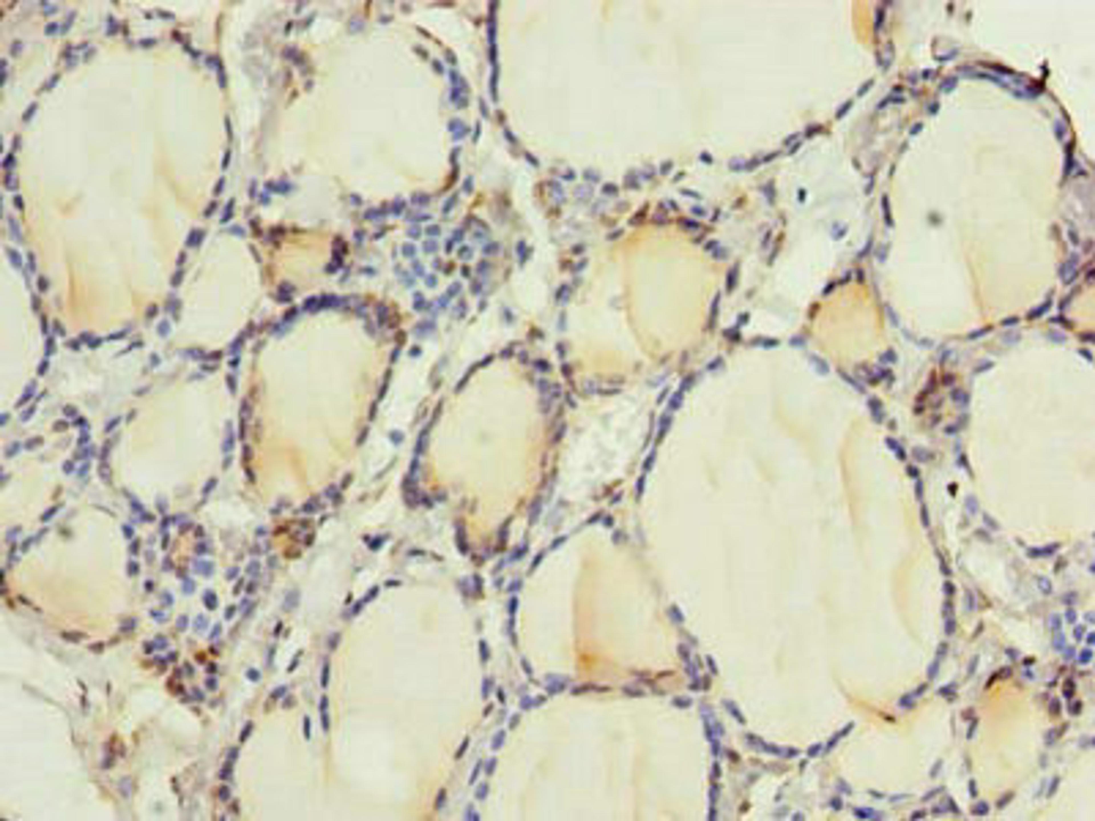 Immunohistochemistry of paraffin-embedded human thyroid tissue using CSB-PA019881LA01HU at dilution of 1:100