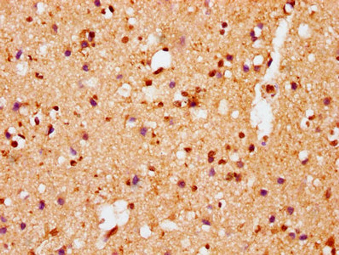 IHC image of CSB-RA021912A129phHU diluted at 1:100 and staining in paraffin-embedded human brain tissue performed on a Leica BondTM system. After dewaxing and hydration, antigen retrieval was mediated by high pressure in a citrate buffer (pH 6.0). Section was blocked with 10% normal goat serum 30min at RT. Then primary antibody (1% BSA) was incubated at 4℃ overnight. The primary is detected by a biotinylated secondary antibody and visualized using an HRP conjugated SP system.