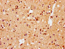 IHC image of CSB-RA021912A129phHU diluted at 1:100 and staining in paraffin-embedded human brain tissue performed on a Leica BondTM system. After dewaxing and hydration, antigen retrieval was mediated by high pressure in a citrate buffer (pH 6.0). Section was blocked with 10% normal goat serum 30min at RT. Then primary antibody (1% BSA) was incubated at 4℃ overnight. The primary is detected by a biotinylated secondary antibody and visualized using an HRP conjugated SP system.