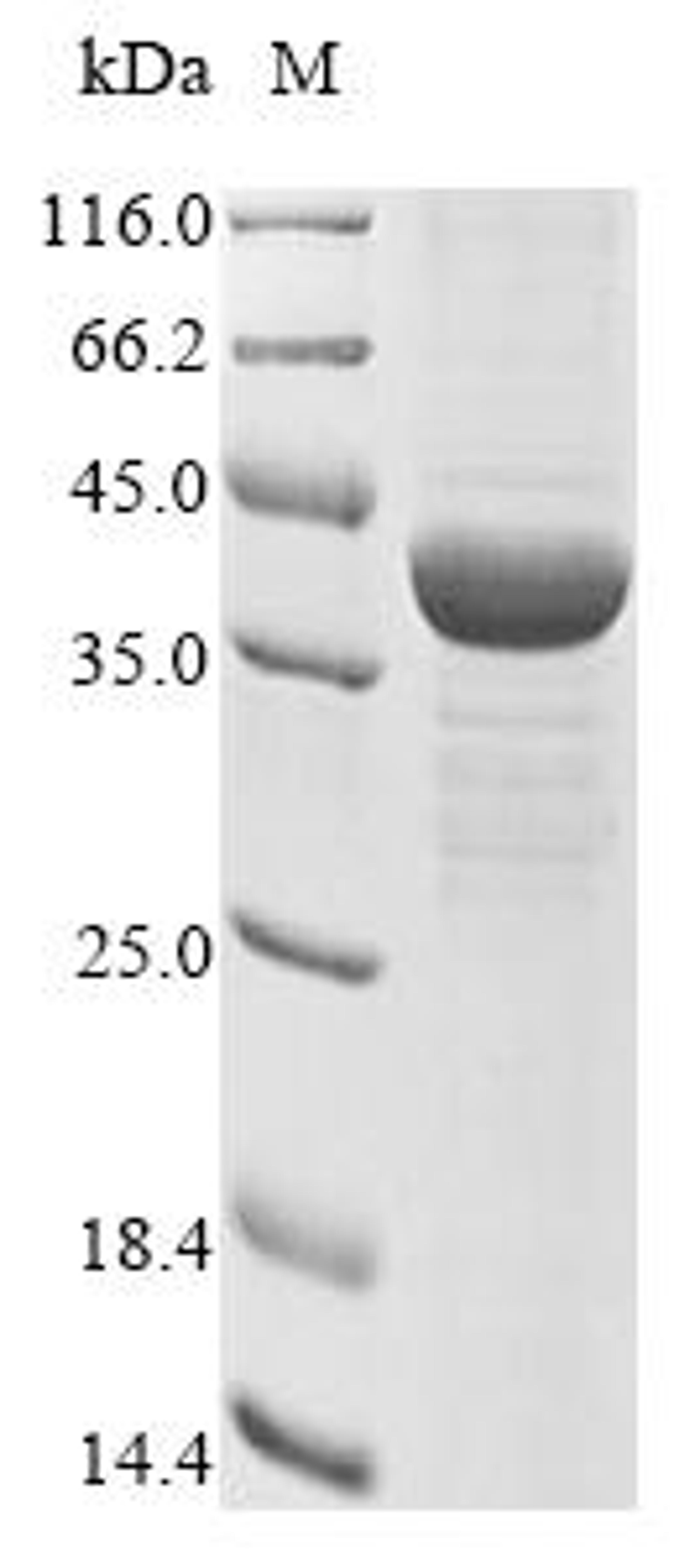 (Tris-Glycine gel) Discontinuous SDS-PAGE (reduced) with 5% enrichment gel and 15% separation gel.