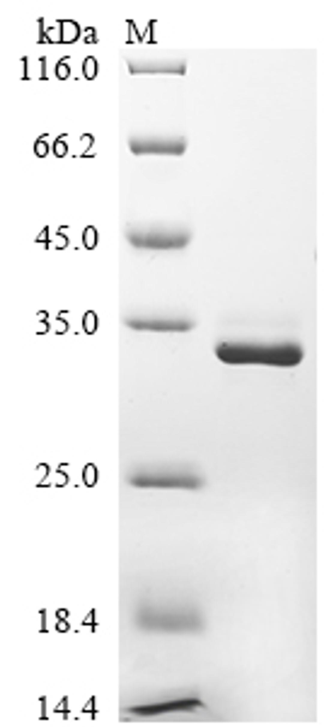 (Tris-Glycine gel) Discontinuous SDS-PAGE (reduced) with 5% enrichment gel and 15% separation gel.
