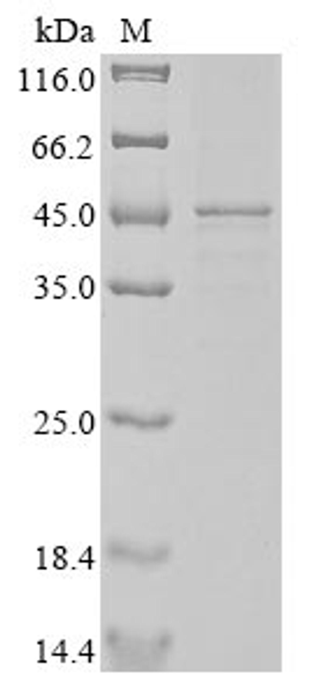 (Tris-Glycine gel) Discontinuous SDS-PAGE (reduced) with 5% enrichment gel and 15% separation gel.