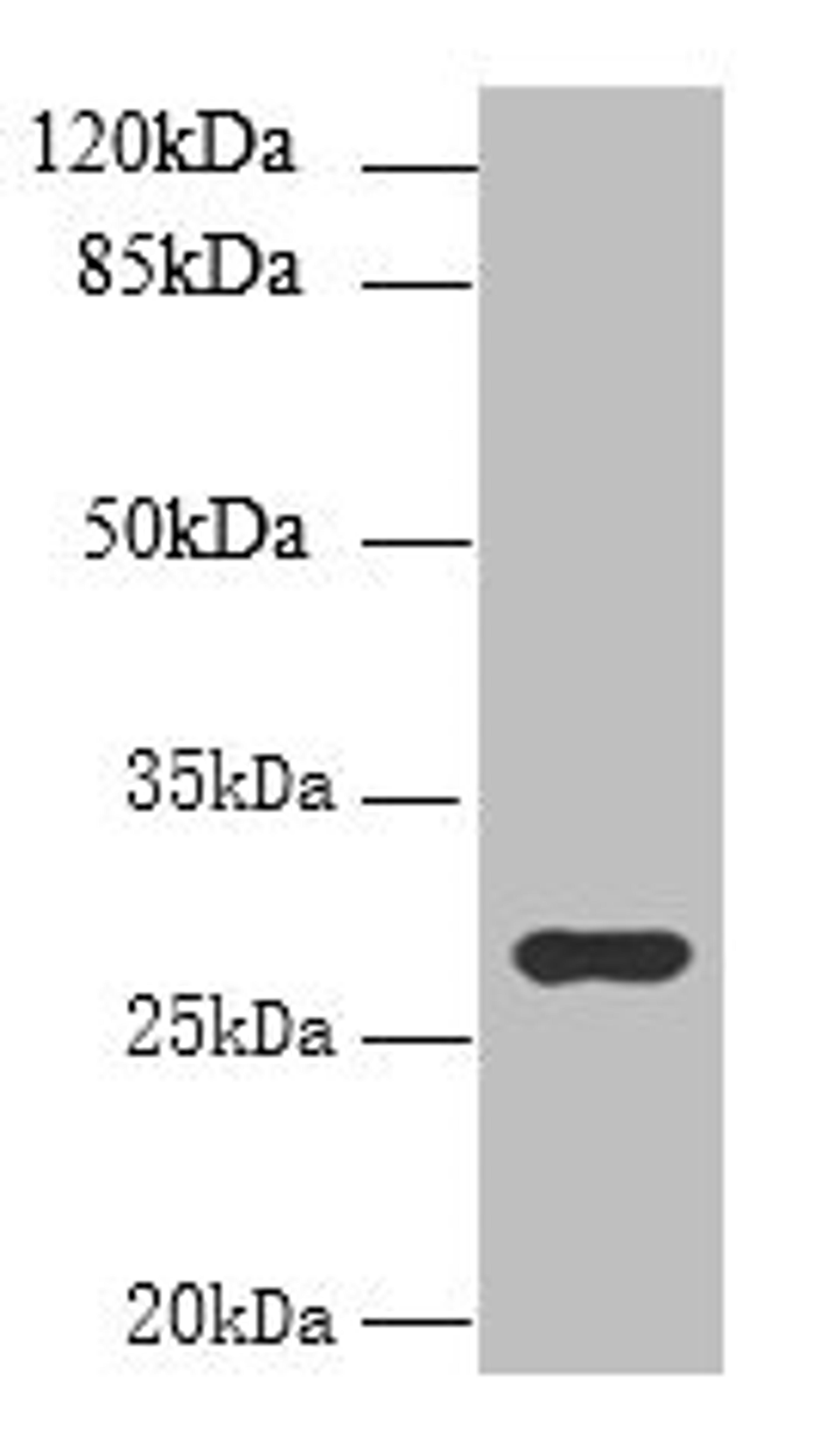 Western blot. All lanes: UTP23 antibody at 7ug/ml + Mouse liver tissue. Secondary. Goat polyclonal to rabbit IgG at 1/10000 dilution. Predicted band size: 29, 17 kDa. Observed band size: 29 kDa. 
