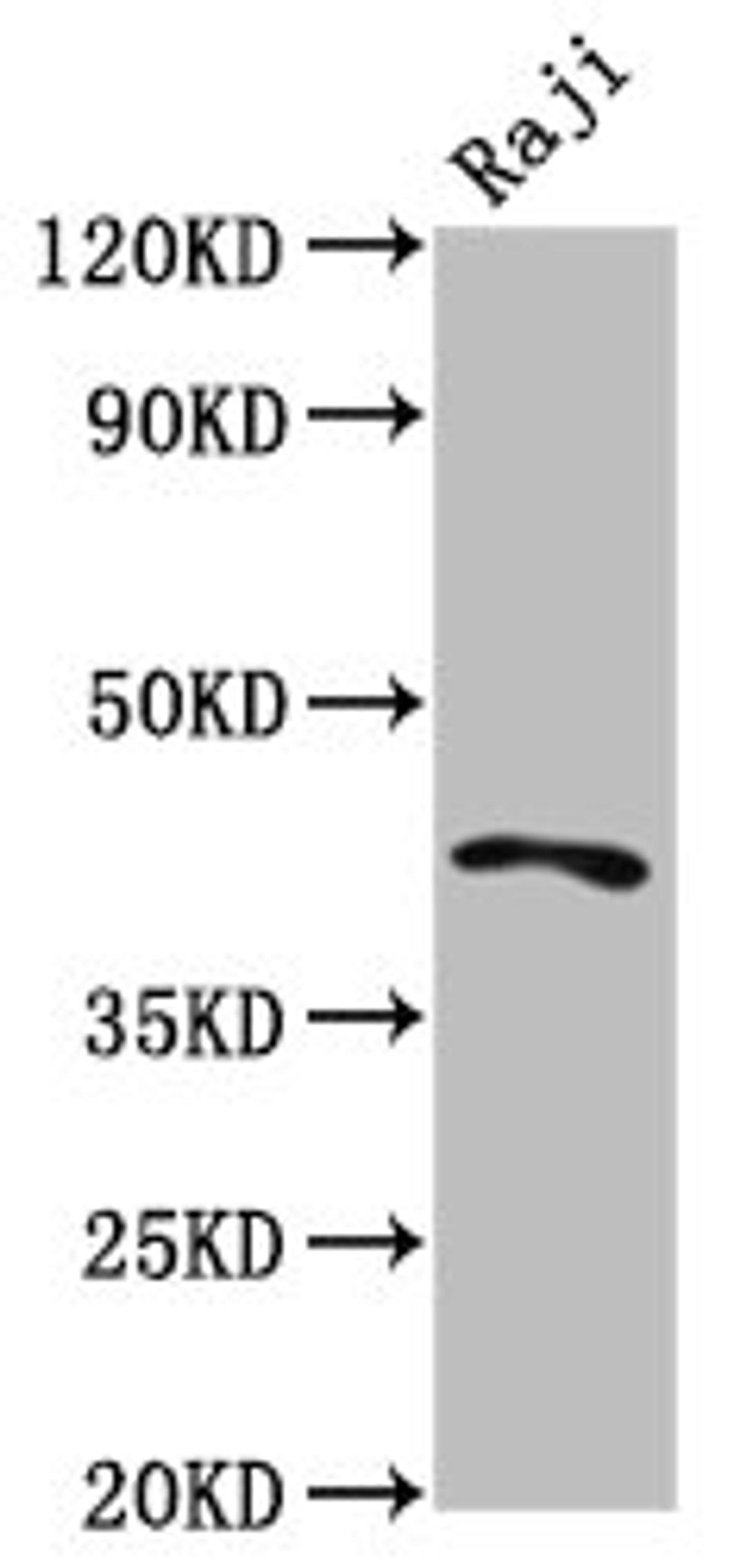 Western Blot. Positive WB detected in: Raji whole cell lysate. All lanes: TRIB1 antibody at 4.3µg/ml. Secondary. Goat polyclonal to rabbit IgG at 1/50000 dilution. Predicted band size: 42, 24 kDa. Observed band size: 42 kDa