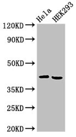 Western Blot. Positive WB detected in: Hela whole cell lysate, HEK293 whole cell lysate. All lanes: ARPC1A antibody at 4ug/ml. Secondary. Goat polyclonal to rabbit IgG at 1/50000 dilution. Predicted band size: 42, 39 kDa. Observed band size: 42 kDa. 
