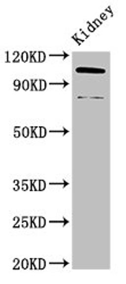 Western Blot. Positive WB detected in: Mouse kidney tissue. All lanes: ACTN4 antibody at 3.4ug/ml. Secondary. Goat polyclonal to rabbit IgG at 1/50000 dilution. Predicted band size: 105, 80, 60 kDa. Observed band size: 105, 80 kDa. 