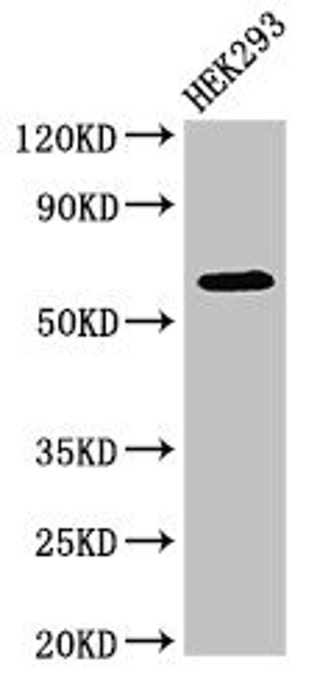 Western Blot. Positive WB detected in: HEK293 whole cell lysate. All lanes: DEPDC1B antibody at 4ug/ml. Secondary. Goat polyclonal to rabbit IgG at 1/50000 dilution. Predicted band size: 62, 55 kDa. Observed band size: 62 kDa.