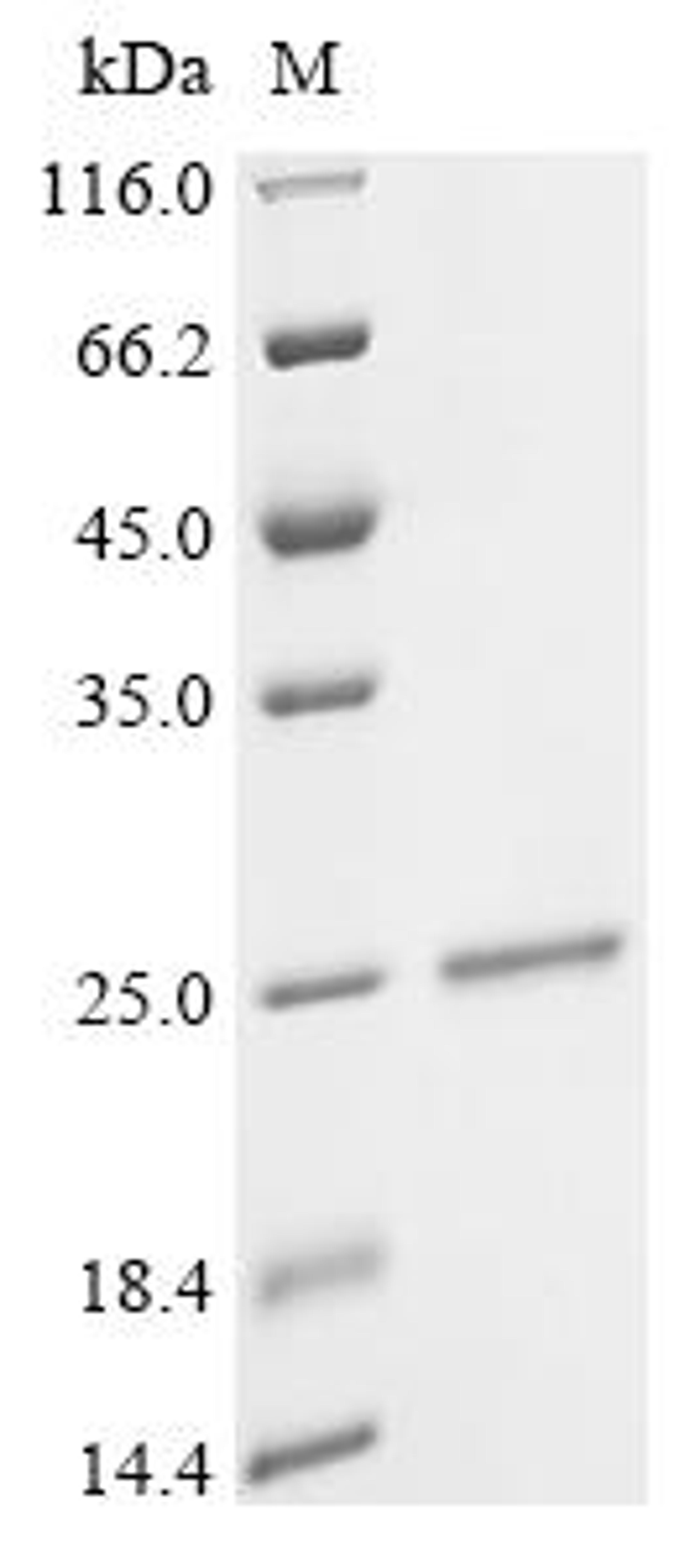(Tris-Glycine gel) Discontinuous SDS-PAGE (reduced) with 5% enrichment gel and 15% separation gel.