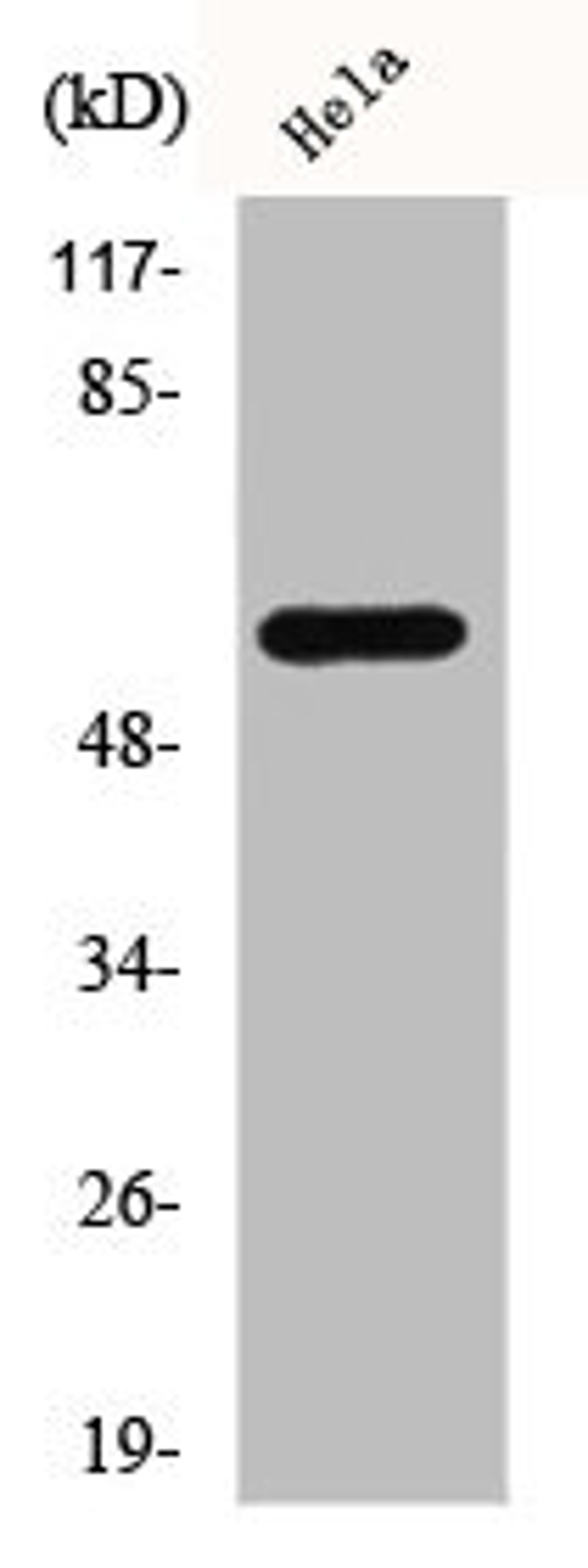 Western Blot analysis of HeLa cells using c-Src Polyclonal Antibody