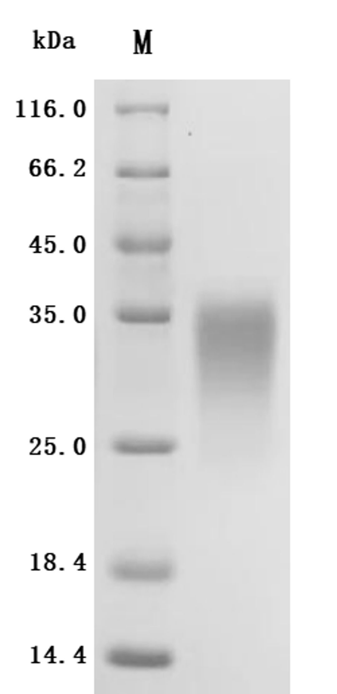 (Tris-Glycine gel) Discontinuous SDS-PAGE (reduced) with 5% enrichment gel and 15% separation gel.