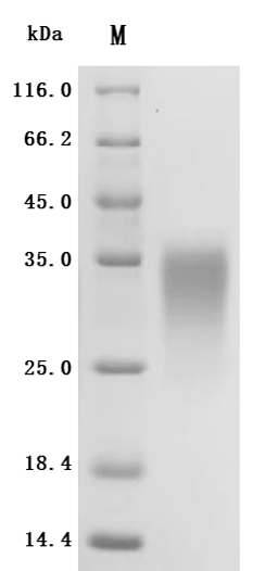 (Tris-Glycine gel) Discontinuous SDS-PAGE (reduced) with 5% enrichment gel and 15% separation gel.