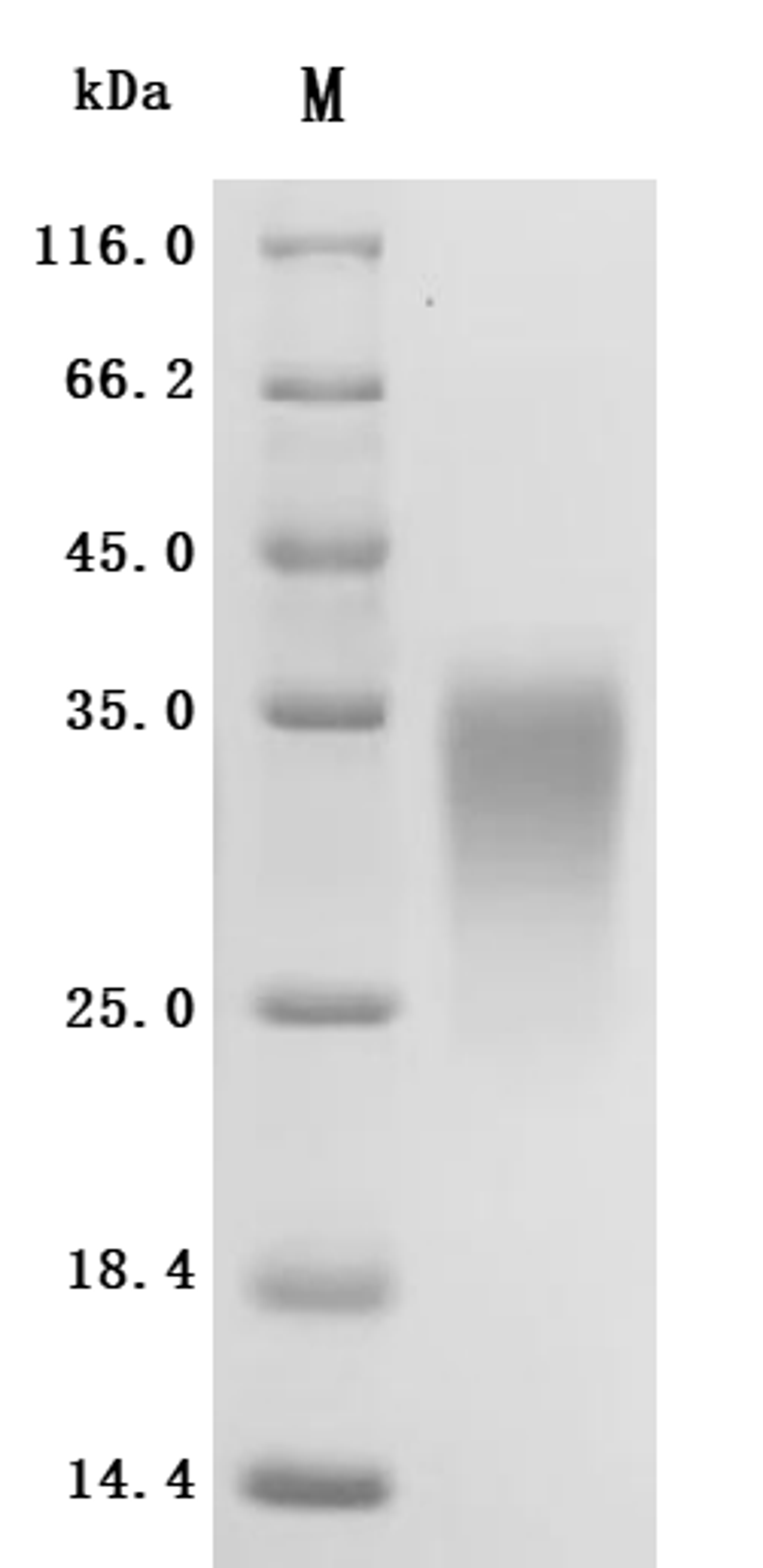 (Tris-Glycine gel) Discontinuous SDS-PAGE (reduced) with 5% enrichment gel and 15% separation gel.