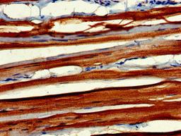 Immunohistochemistry of paraffin-embedded human skeletal muscle tissue using CSB-PA618884LA01HU at dilution of 1:100