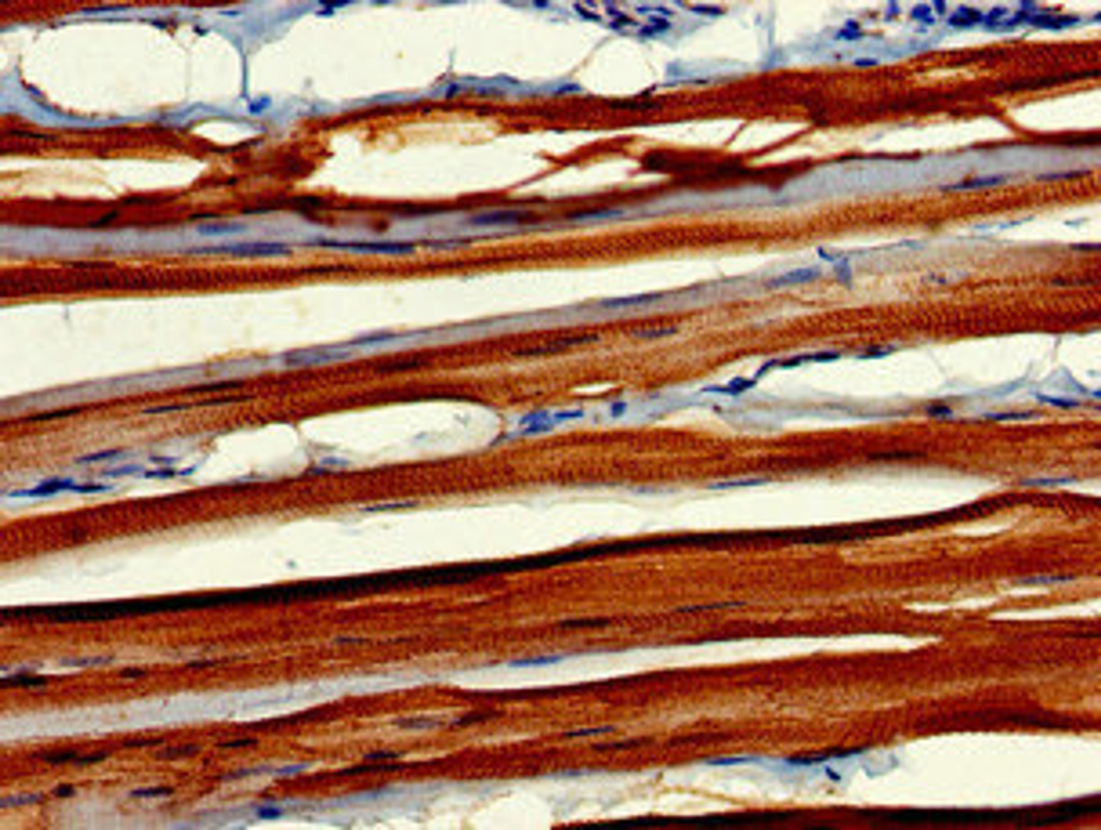 Immunohistochemistry of paraffin-embedded human skeletal muscle tissue using CSB-PA618884LA01HU at dilution of 1:100
