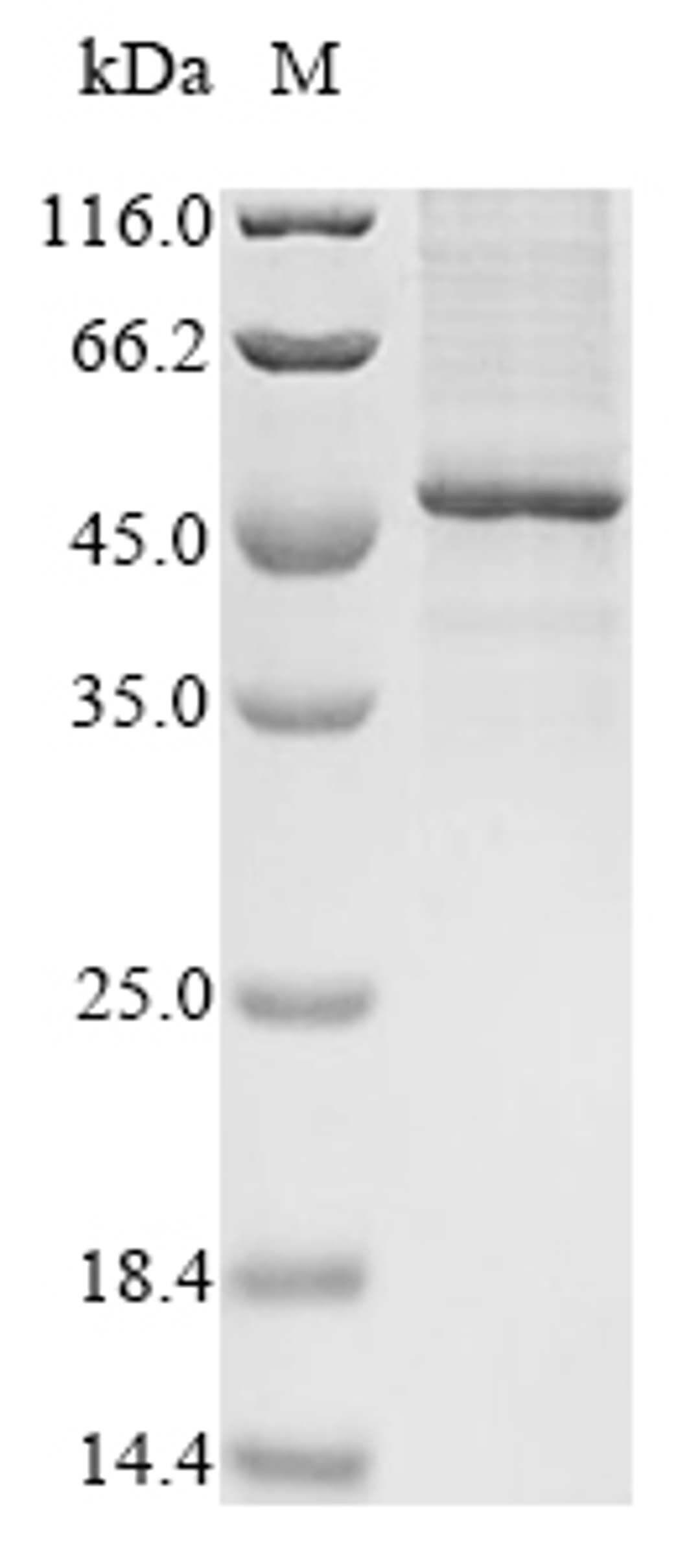 (Tris-Glycine gel) Discontinuous SDS-PAGE (reduced) with 5% enrichment gel and 15% separation gel.