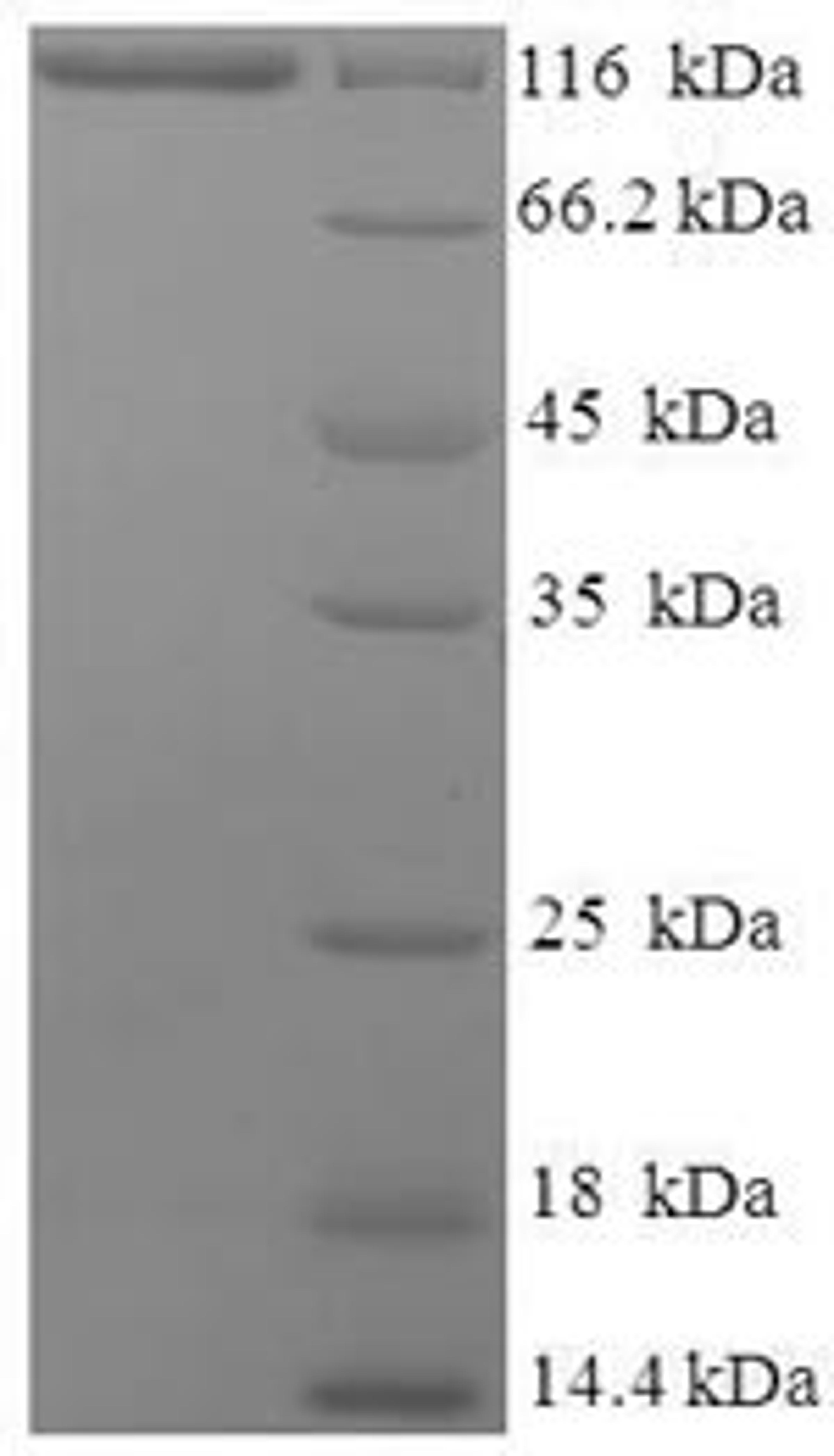 (Tris-Glycine gel) Discontinuous SDS-PAGE (reduced) with 5% enrichment gel and 15% separation gel.