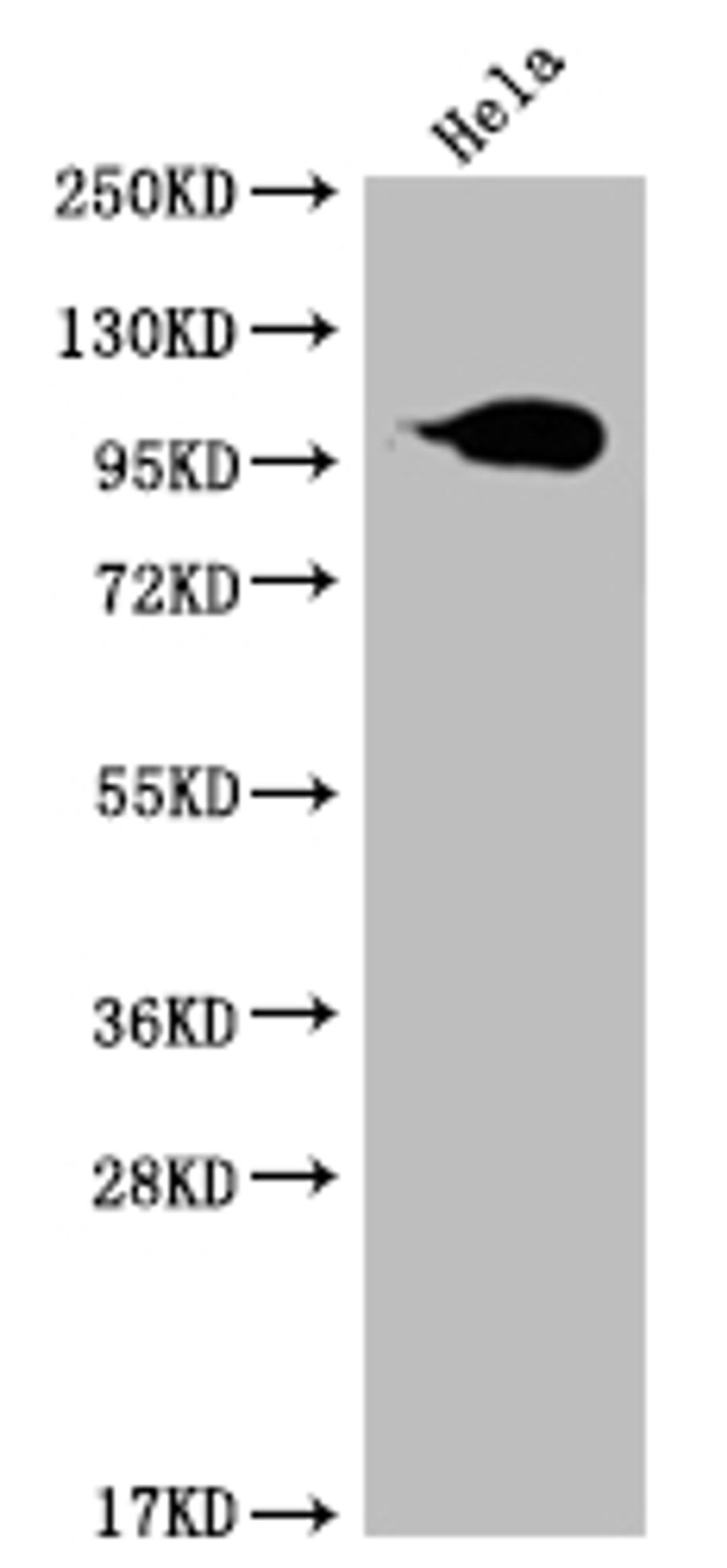 Western Blot. Positive WB detected in: Hela whole cell lysate. All lanes: ACO1 antibody at 1:2000. Secondary. Goat polyclonal to rabbit IgG at 1/50000 dilution. Predicted band size: 100 kDa. Observed band size: 95-130 kDa.