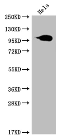 Western Blot. Positive WB detected in: Hela whole cell lysate. All lanes: ACO1 antibody at 1:2000. Secondary. Goat polyclonal to rabbit IgG at 1/50000 dilution. Predicted band size: 100 kDa. Observed band size: 95-130 kDa.