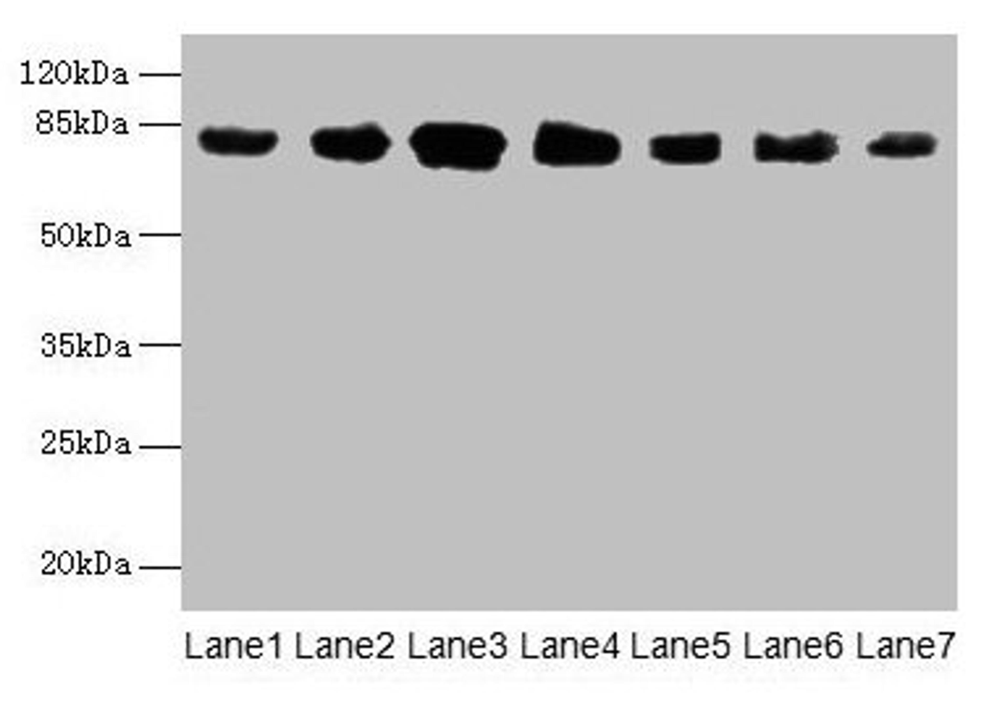 Western blot. All lanes: CLGN antibody at 7µg/ml. Lane 1: Mouse brain tissue. Lane 2: Mouse lung tissue. Lane 3: Jurkat whole cell lysate. Lane 4: HepG2 whole cell lysate. Lane 5: PC-3 whole cell lysate. Lane 6: Hela whole cell lysate. Lane 7: HL60 whole cell lysate. Secondary. Goat polyclonal to rabbit IgG at 1/10000 dilution. Predicted band size: 71, 47 kDa. Observed band size: 80 kDa