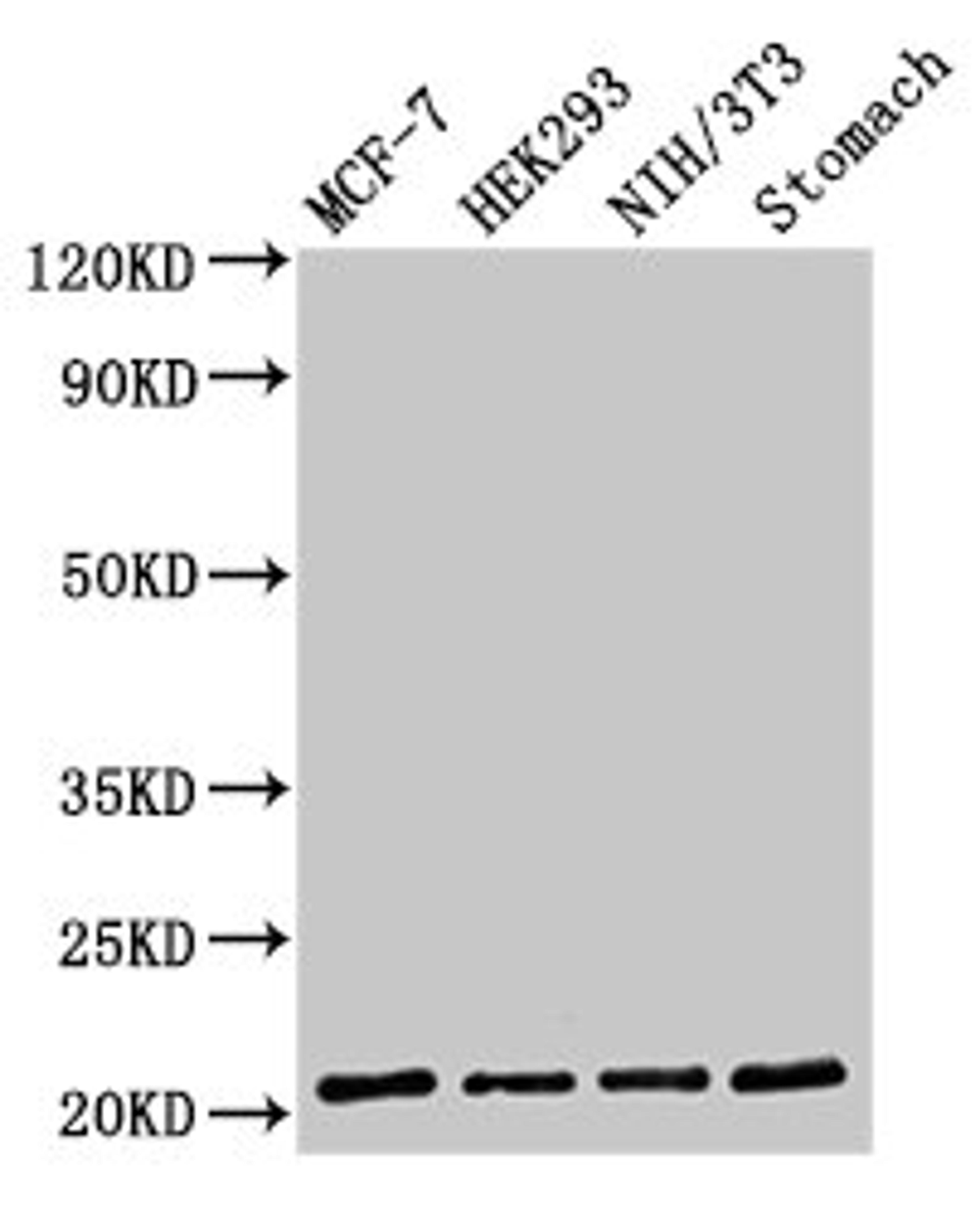 Western Blot. Positive WB detected in: MCF-7 whole cell lysate, HEK293 whole cell lysate, NIH/3T3 whole cell lysate, Rat stomach tissue. All lanes: CD3G antibody at 2µg/ml. Secondary. Goat polyclonal to rabbit IgG at 1/50000 dilution. Predicted band size: 21 kDa. Observed band size: 21 kDa