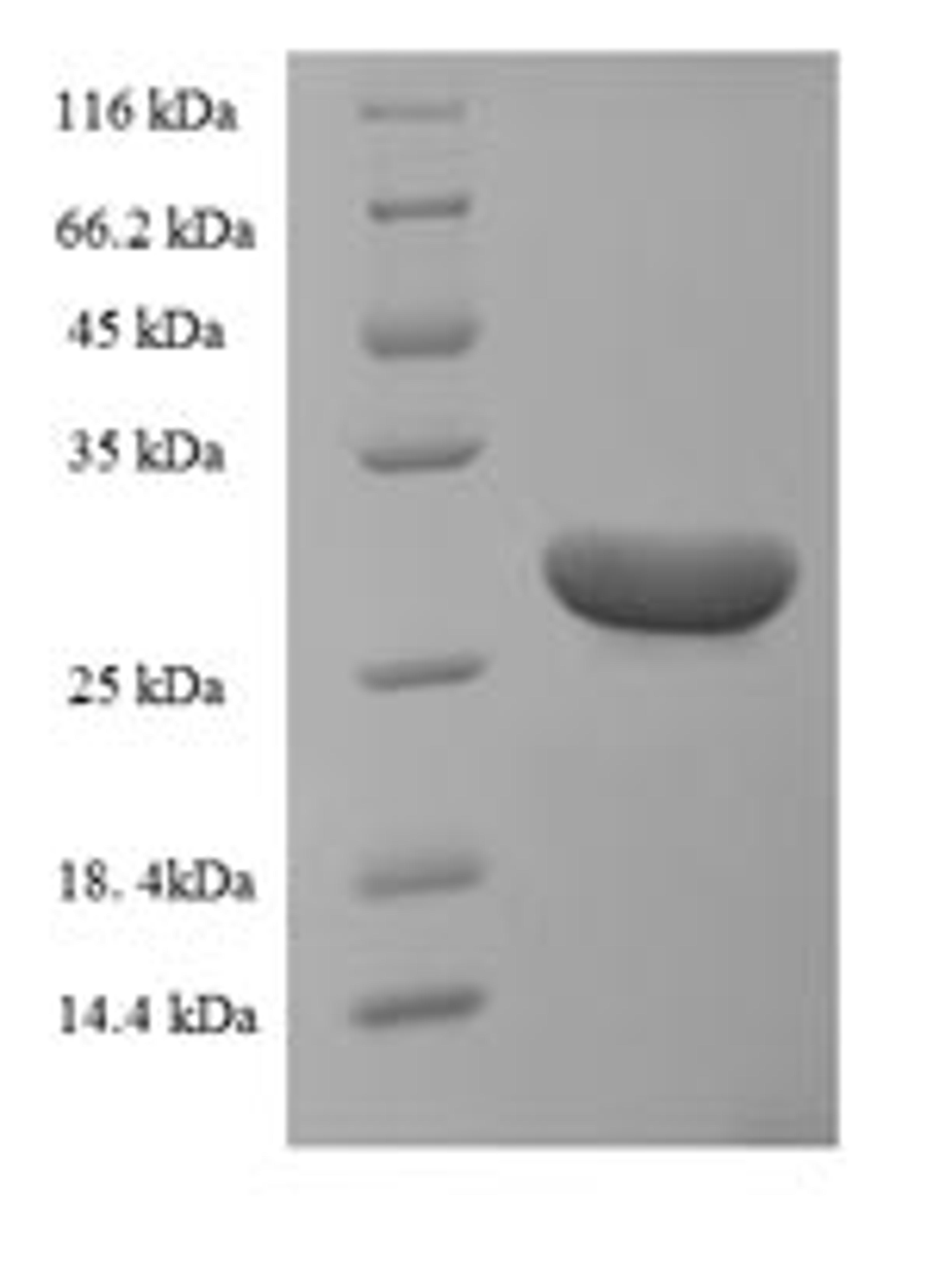 (Tris-Glycine gel) Discontinuous SDS-PAGE (reduced) with 5% enrichment gel and 15% separation gel.