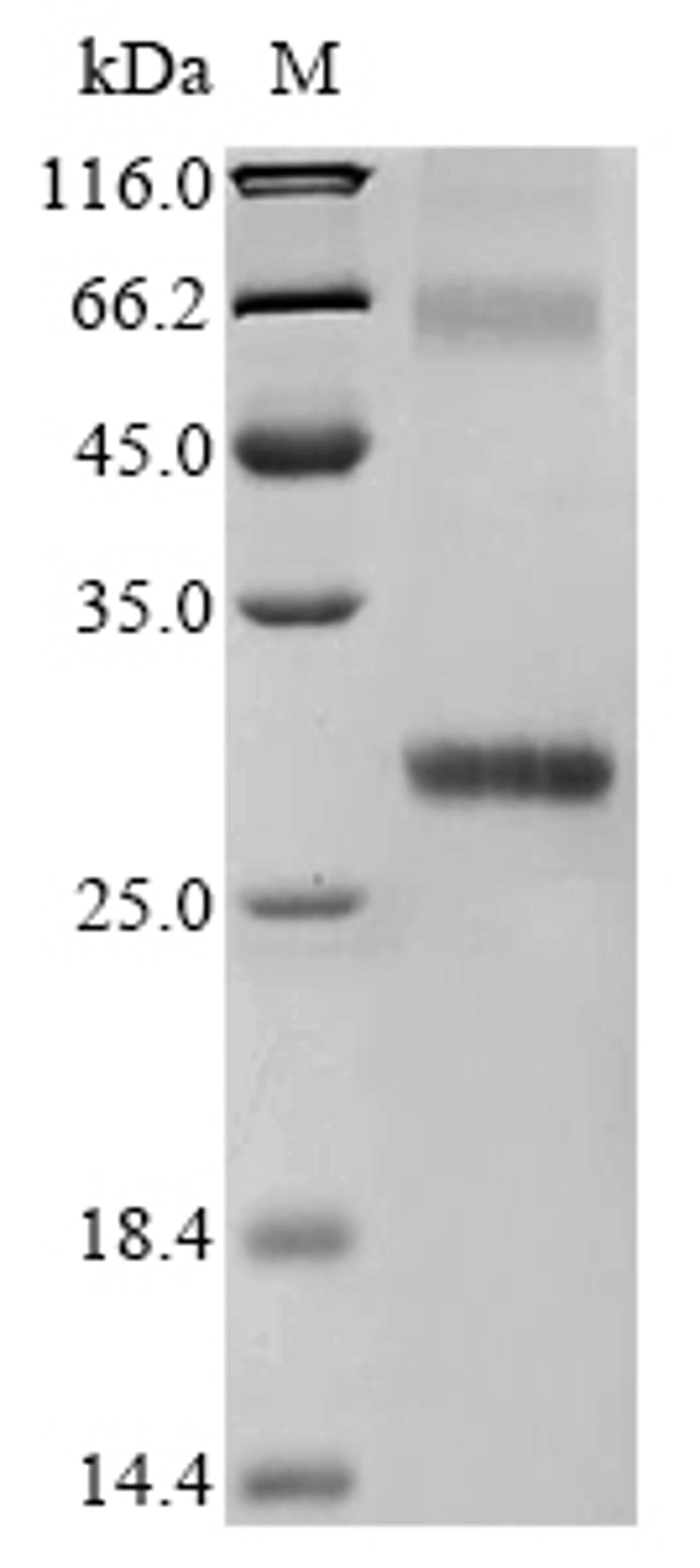 (Tris-Glycine gel) Discontinuous SDS-PAGE (reduced) with 5% enrichment gel and 15% separation gel.