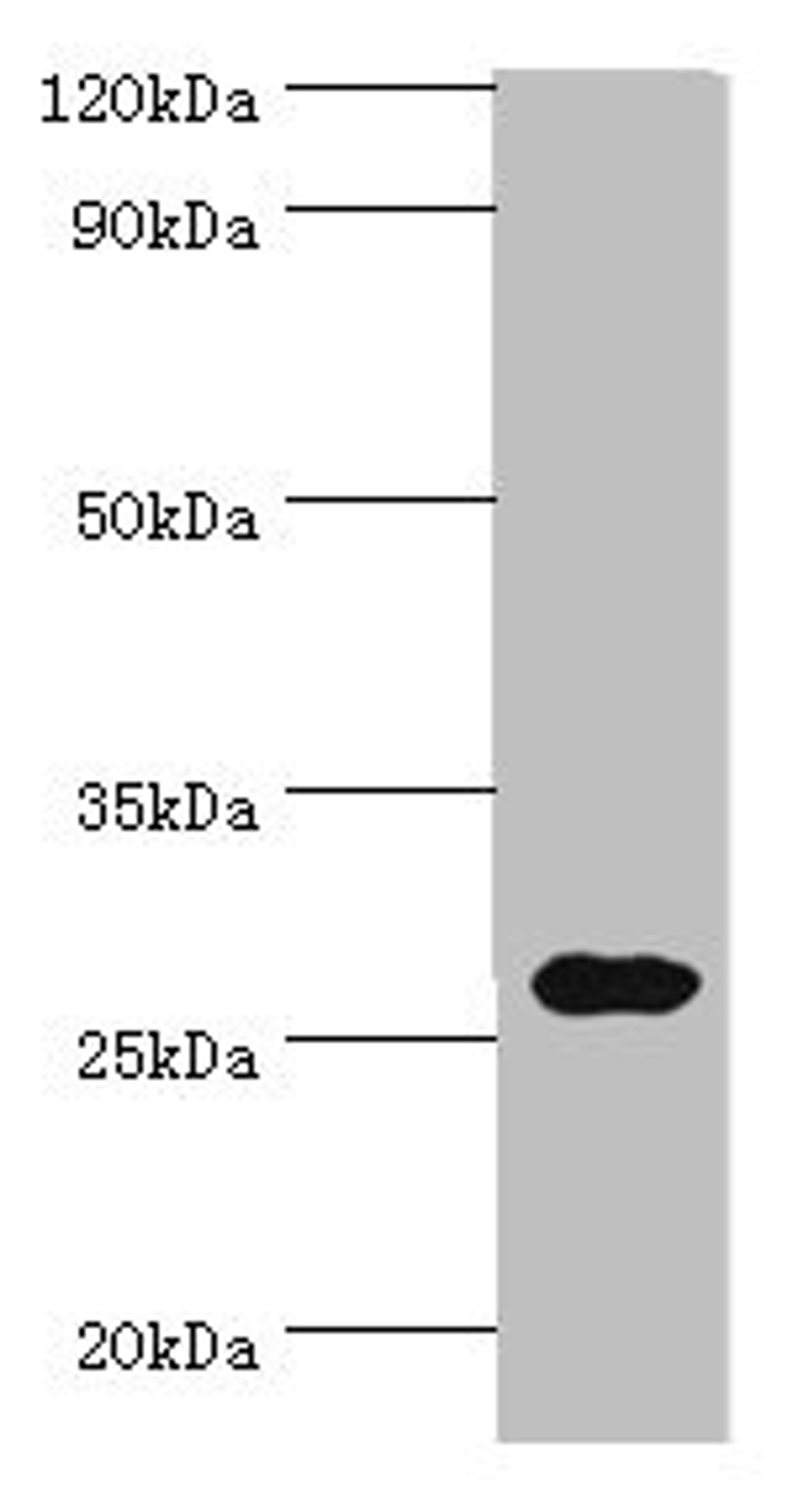 Western blot. All lanes: CRISP2 antibody at 12ug/ml + Rat gonad tissue. Secondary. Goat polyclonal to rabbit IgG at 1/10000 dilution. Predicted band size: 28, 32 kDa. Observed band size: 28 kDa. 