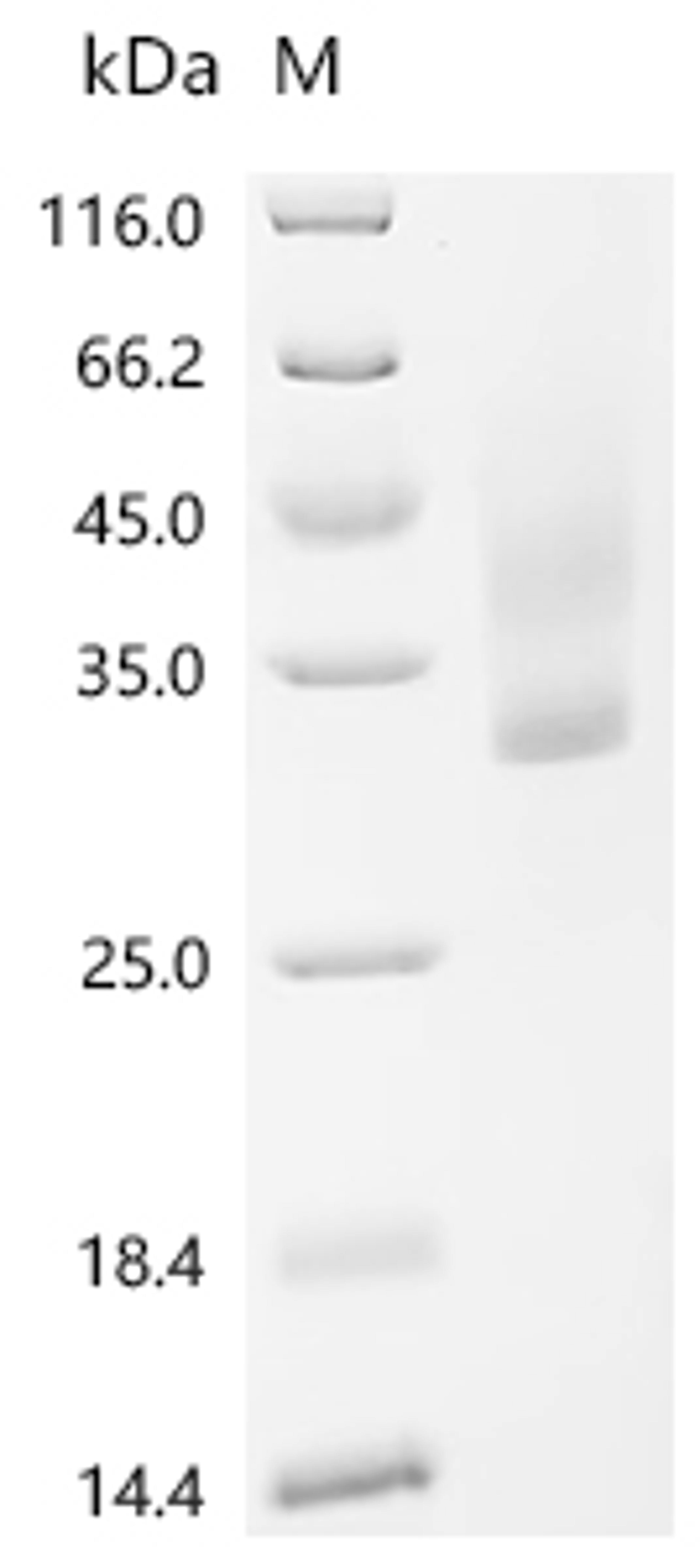 (Tris-Glycine gel) Discontinuous SDS-PAGE (reduced) with 5% enrichment gel and 15% separation gel.