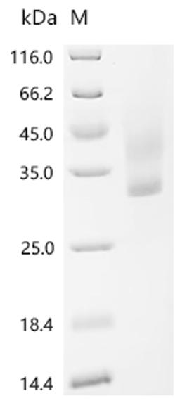 (Tris-Glycine gel) Discontinuous SDS-PAGE (reduced) with 5% enrichment gel and 15% separation gel.
