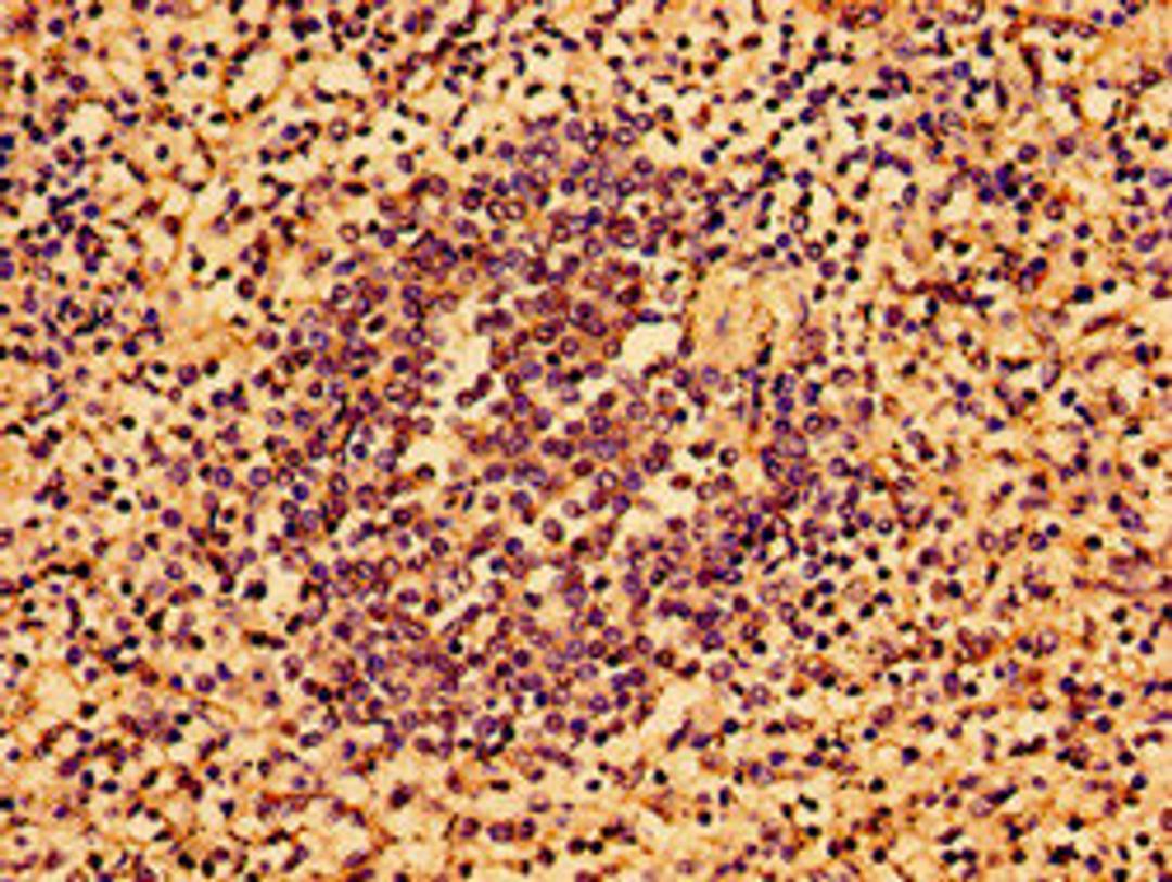 Immunohistochemistry of paraffin-embedded human spleen tissue using CSB-PA747468LA01HU at dilution of 1:100