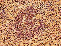 Immunohistochemistry of paraffin-embedded human spleen tissue using CSB-PA747468LA01HU at dilution of 1:100