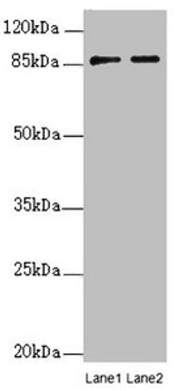 Western blot. All lanes: SUPT20H antibody at 0.21ug/ml. Lane 1: Mouse lung tissue. Lane 2: Mouse kidney tissue. Secondary. Goat polyclonal to rabbit IgG at 1/10000 dilution. Predicted band size: 86, 81, 89 kDa. Observed band size: 86 kDa. 