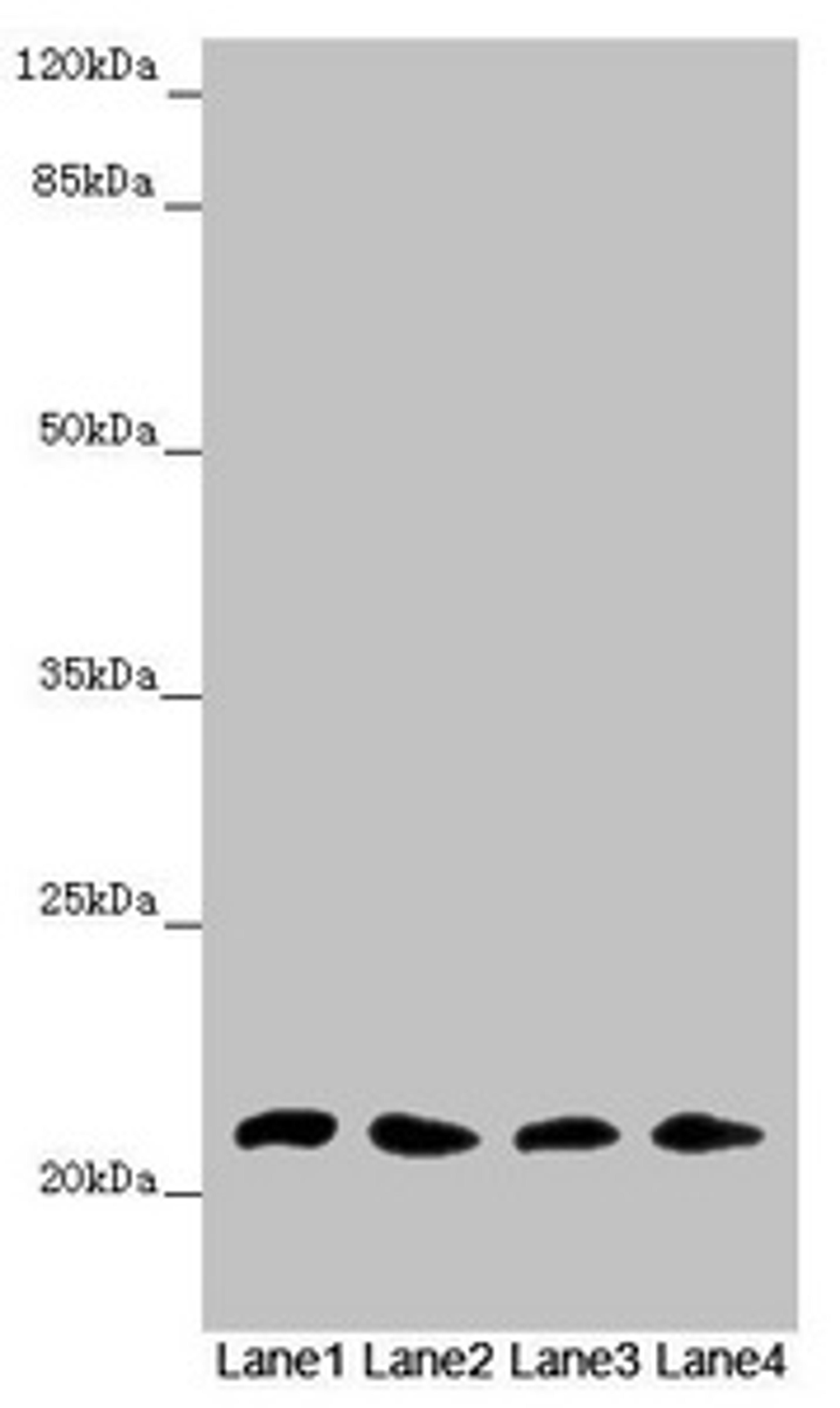 Western blot. All lanes: MSRB3 antibody at 4.61 ug/ml. Lane 1: Mouse large intestine tissue. Lane 2: Mouse lung tissue. Lane 3: Mouse gonadal tissue. Lane 4: Mouse heart tissue. Secondary. Goat polyclonal to rabbit IgG at 1/10000 dilution. Predicted band size: 21 kDa. Observed band size: 21 kDa.