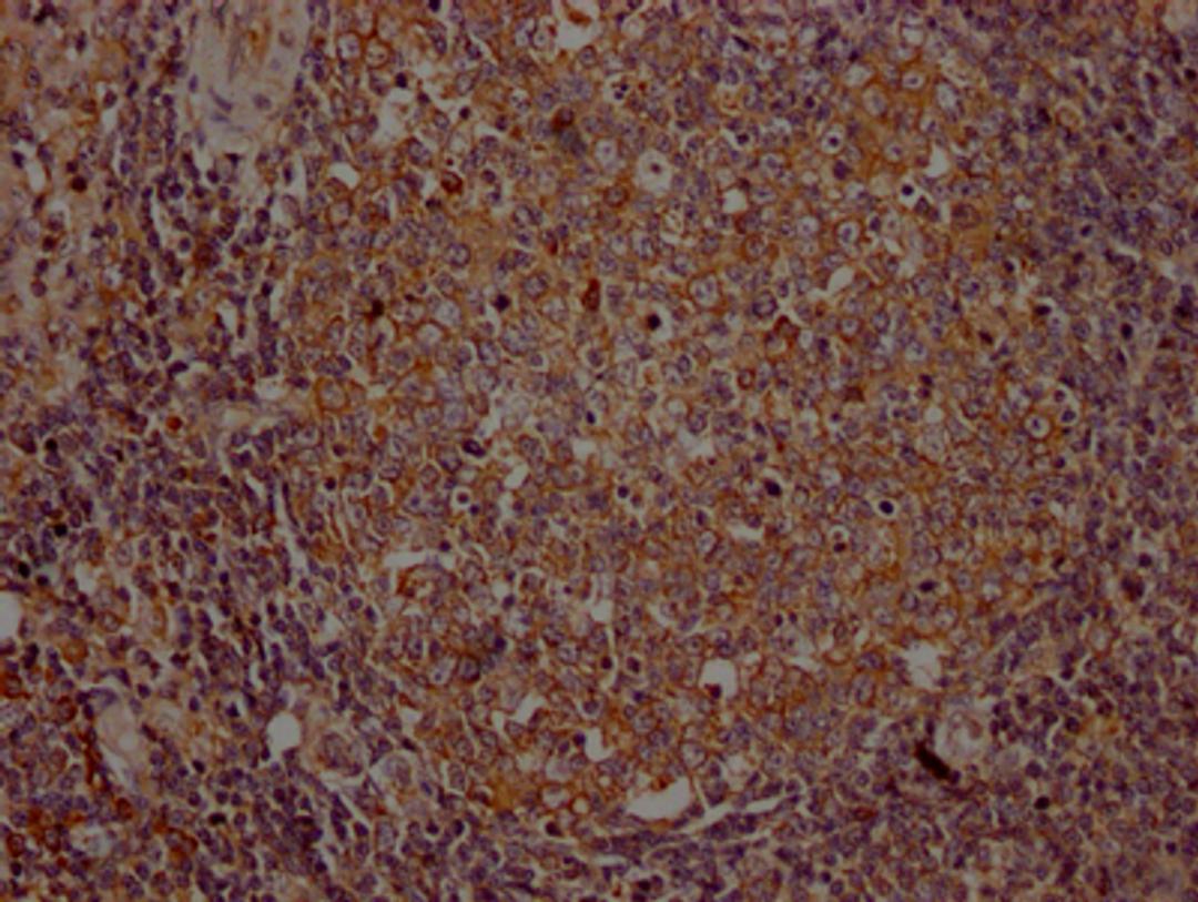 IHC image of CSB-RA954682A0HU diluted at 1:100 and staining in paraffin-embedded human lymph node tissue performed on a Leica BondTM system. After dewaxing and hydration, antigen retrieval was mediated by high pressure in a citrate buffer (pH 6.0). Section was blocked with 10% normal goat serum 30min at RT. Then primary antibody (1% BSA) was incubated at 4℃ overnight. The primary is detected by a Goat anti-rabbit IgG polymer labeled by HRP and visualized using 0.05% DAB.