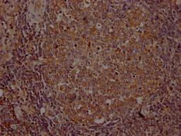 IHC image of CSB-RA954682A0HU diluted at 1:100 and staining in paraffin-embedded human lymph node tissue performed on a Leica BondTM system. After dewaxing and hydration, antigen retrieval was mediated by high pressure in a citrate buffer (pH 6.0). Section was blocked with 10% normal goat serum 30min at RT. Then primary antibody (1% BSA) was incubated at 4℃ overnight. The primary is detected by a Goat anti-rabbit IgG polymer labeled by HRP and visualized using 0.05% DAB.