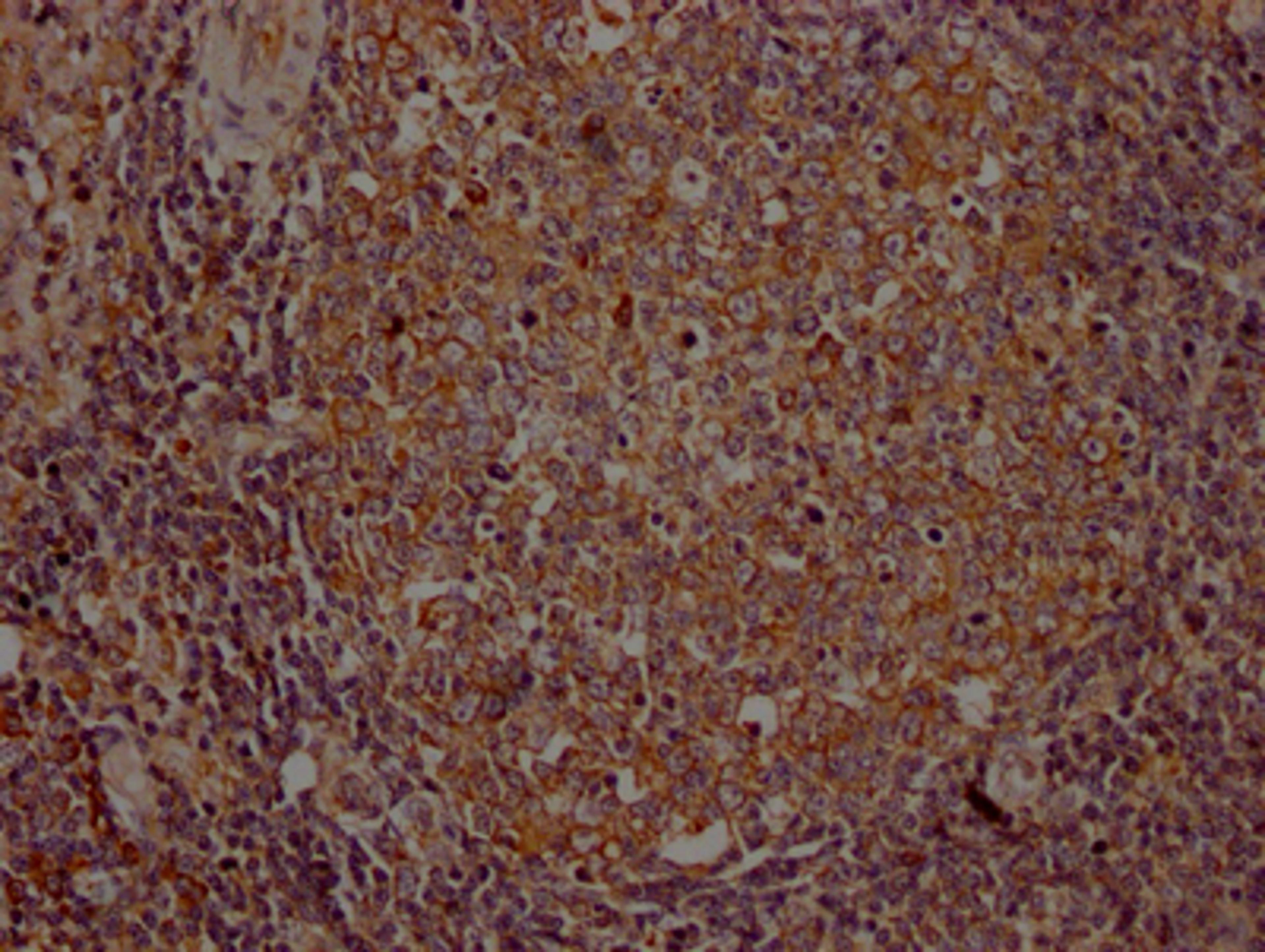 IHC image of CSB-RA954682A0HU diluted at 1:100 and staining in paraffin-embedded human lymph node tissue performed on a Leica BondTM system. After dewaxing and hydration, antigen retrieval was mediated by high pressure in a citrate buffer (pH 6.0). Section was blocked with 10% normal goat serum 30min at RT. Then primary antibody (1% BSA) was incubated at 4℃ overnight. The primary is detected by a Goat anti-rabbit IgG polymer labeled by HRP and visualized using 0.05% DAB.