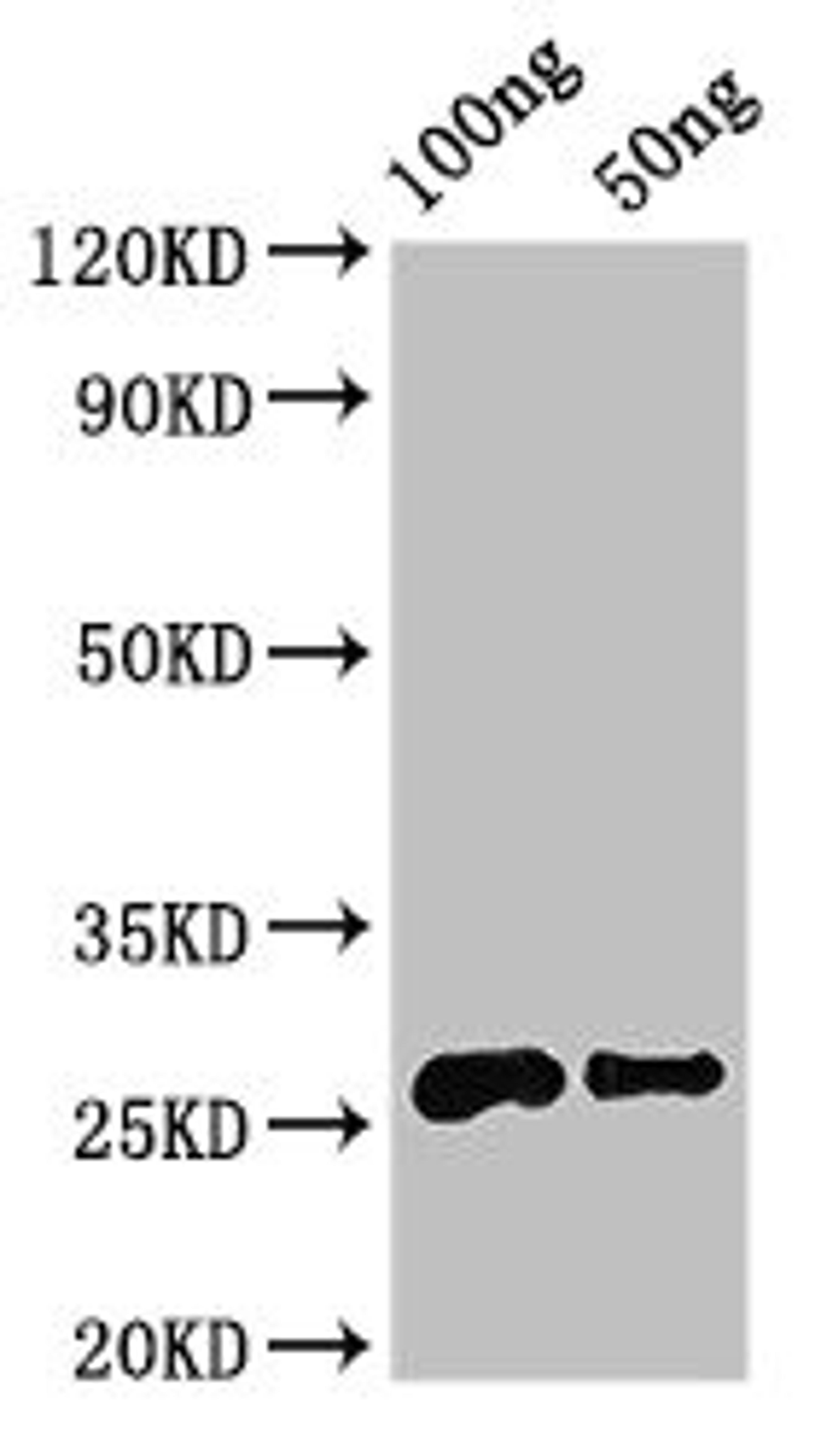 Western Blot. Positive WB detected in Recombinant protein. All lanes: MALD3 antibody at 3.2ug/ml. Secondary. Goat polyclonal to rabbit IgG at 1/50000 dilution. predicted band size: 26 kDa. observed band size: 26 kDa. 