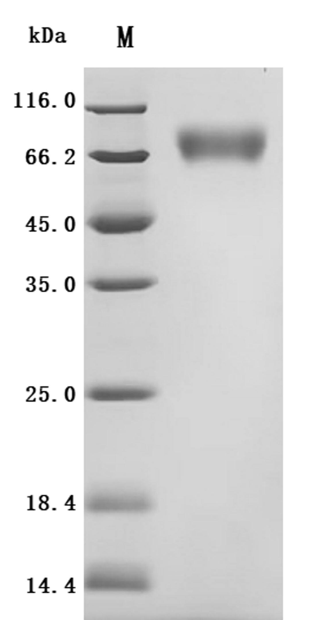 (Tris-Glycine gel) Discontinuous SDS-PAGE (reduced) with 5% enrichment gel and 15% separation gel.