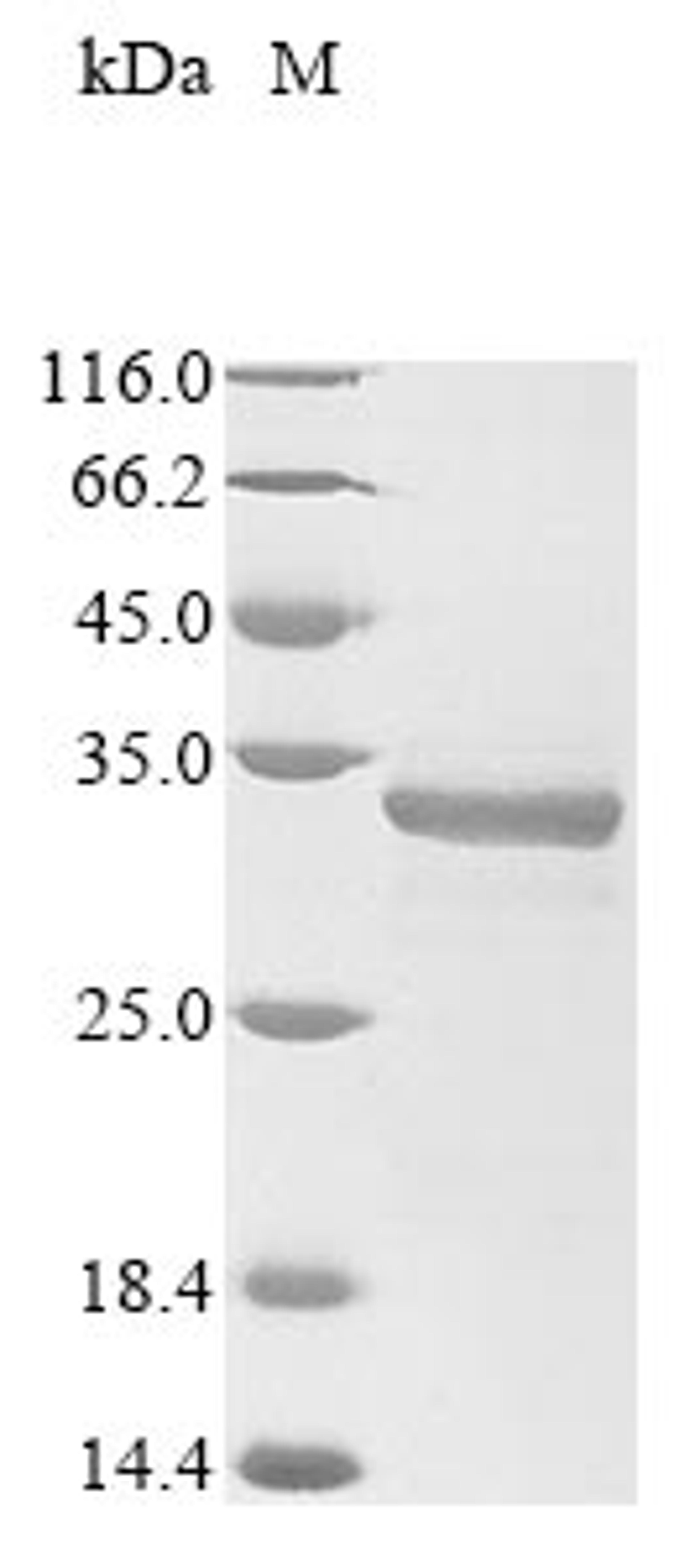 (Tris-Glycine gel) Discontinuous SDS-PAGE (reduced) with 5% enrichment gel and 15% separation gel.