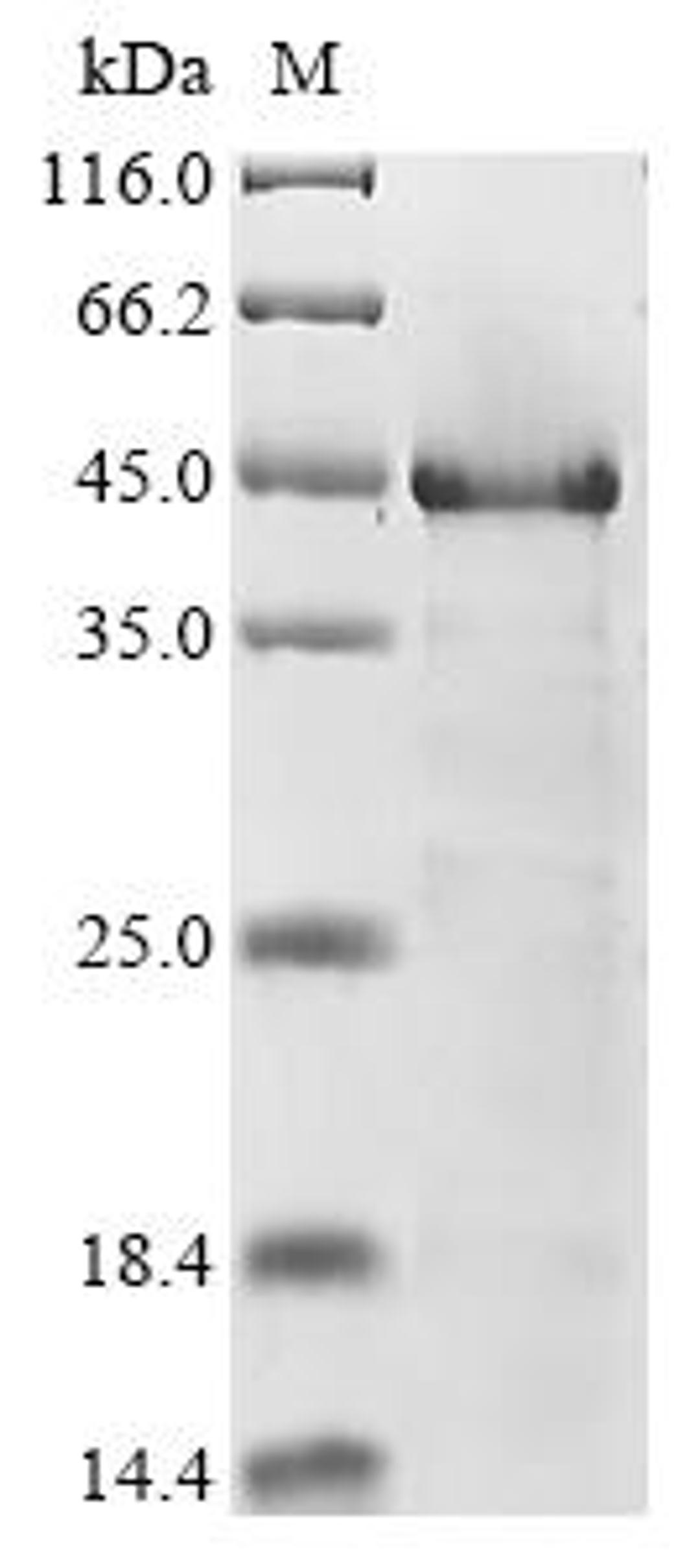 (Tris-Glycine gel) Discontinuous SDS-PAGE (reduced) with 5% enrichment gel and 15% separation gel.