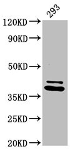 Western Blot. Positive WB detected in: 293 whole cell lysate. All lanes: PSMD7 antibody at 3.2ug/ml. Secondary. Goat polyclonal to rabbit IgG at 1/50000 dilution. Predicted band size: 38 kDa. Observed band size: 38 kDa. 