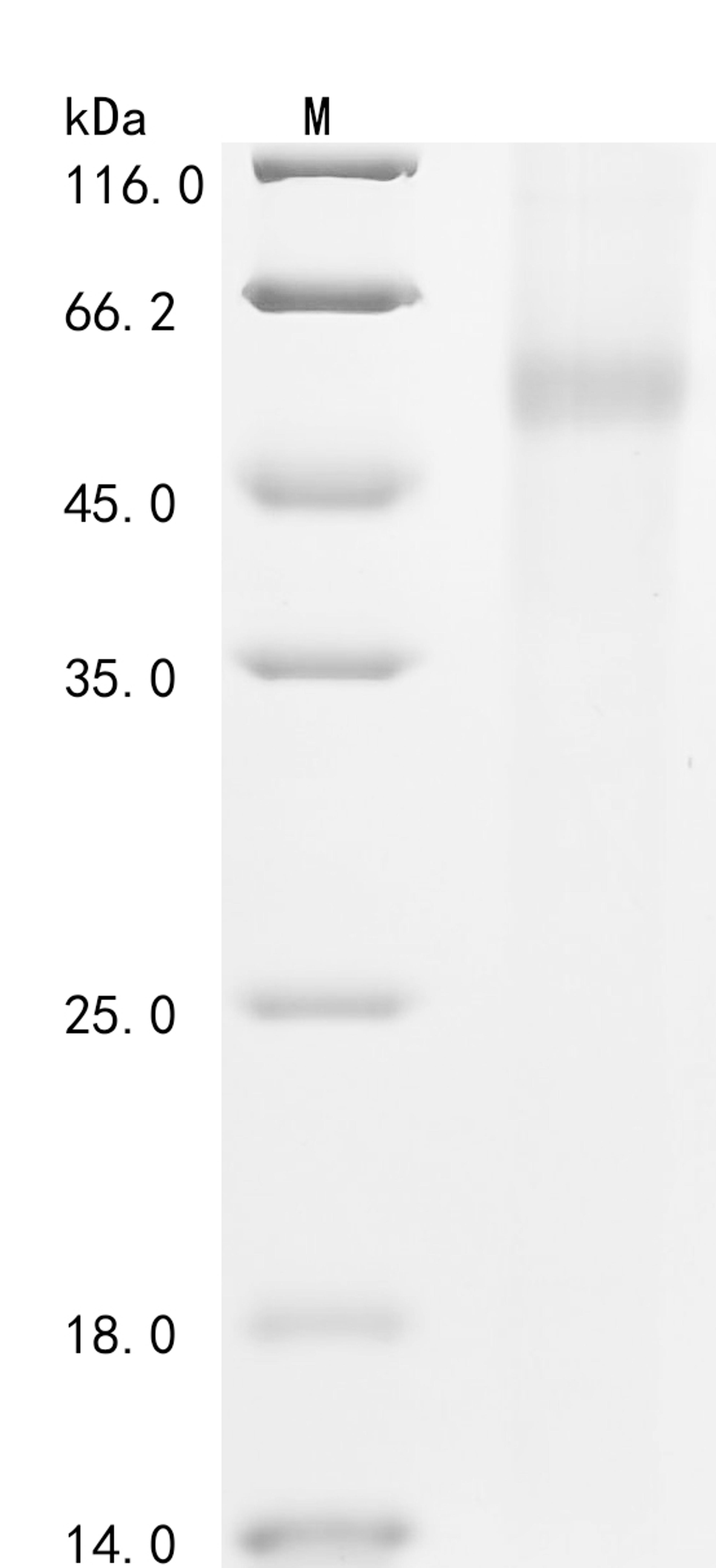 (Tris-Glycine gel) Discontinuous SDS-PAGE (reduced) with 5% enrichment gel and 15% separation gel.