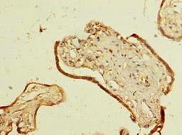 Immunohistochemistry of paraffin-embedded human placenta tissue using CSB-PA857012LA01HU at dilution of 1:100