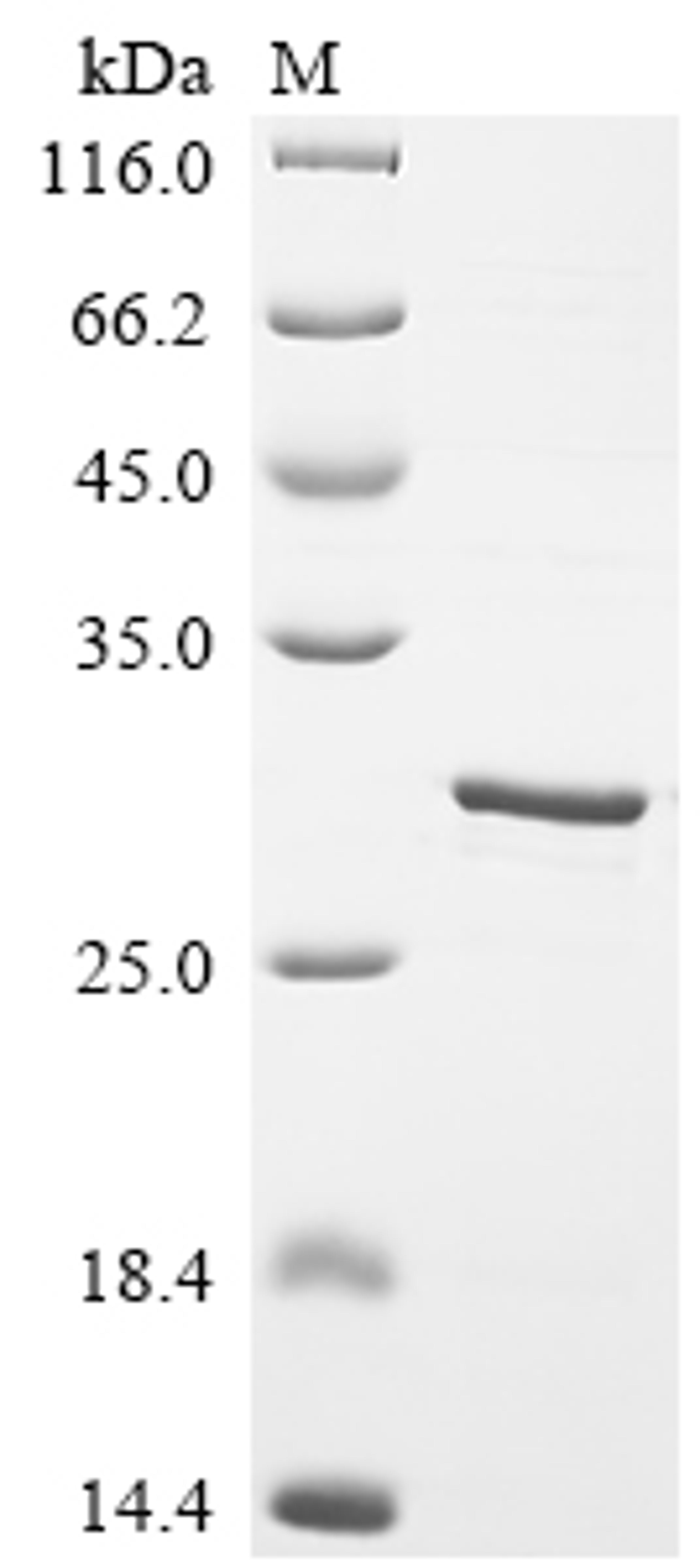 (Tris-Glycine gel) Discontinuous SDS-PAGE (reduced) with 5% enrichment gel and 15% separation gel.