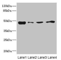Western blot. All lanes: PDK3 antibody at 1.6µg/ml. Lane 1: Mouse kidney tissue. Lane 2: RAW264.7 whole cell lysate. Lane 3: A431 whole cell lysate. Lane 4: HepG2 whole cell lysate. Secondary. Goat polyclonal to rabbit IgG at 1/10000 dilution. Predicted band size: 47, 49 kDa. Observed band size: 47 kDa