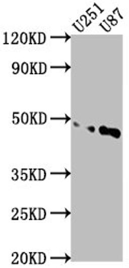 Western Blot. Positive WB detected in: U251 whole cell lysate, U87 whole cell lysate. All lanes: OTUD3 antibody at 1:1000. Secondary. Goat polyclonal to rabbit IgG at 1/50000 dilution. Predicted band size: 46 kDa. Observed band size: 46 kDa. 