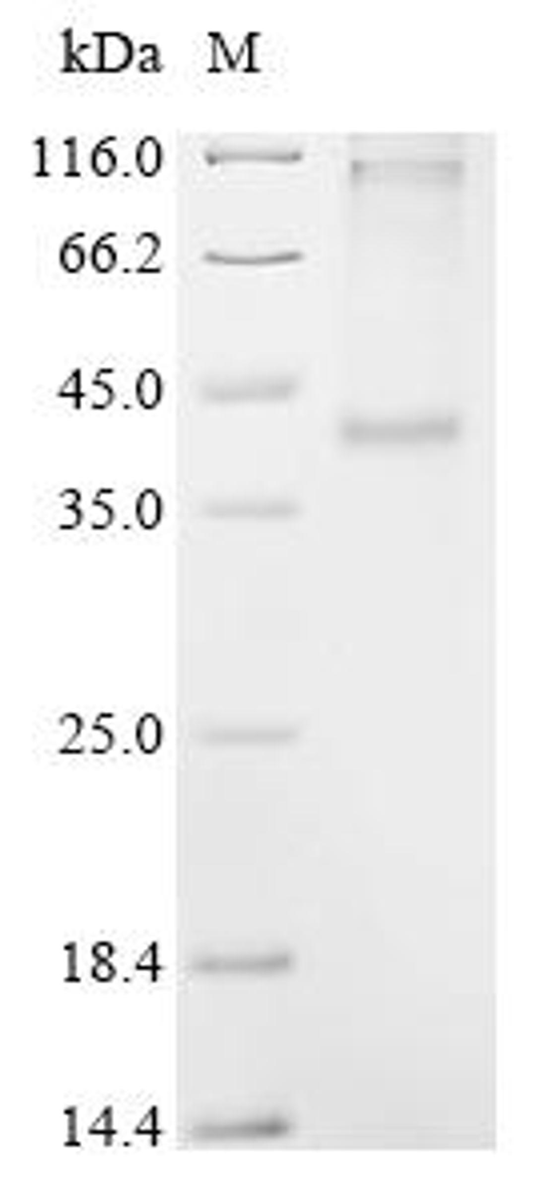 (Tris-Glycine gel) Discontinuous SDS-PAGE (reduced) with 5% enrichment gel and 15% separation gel.