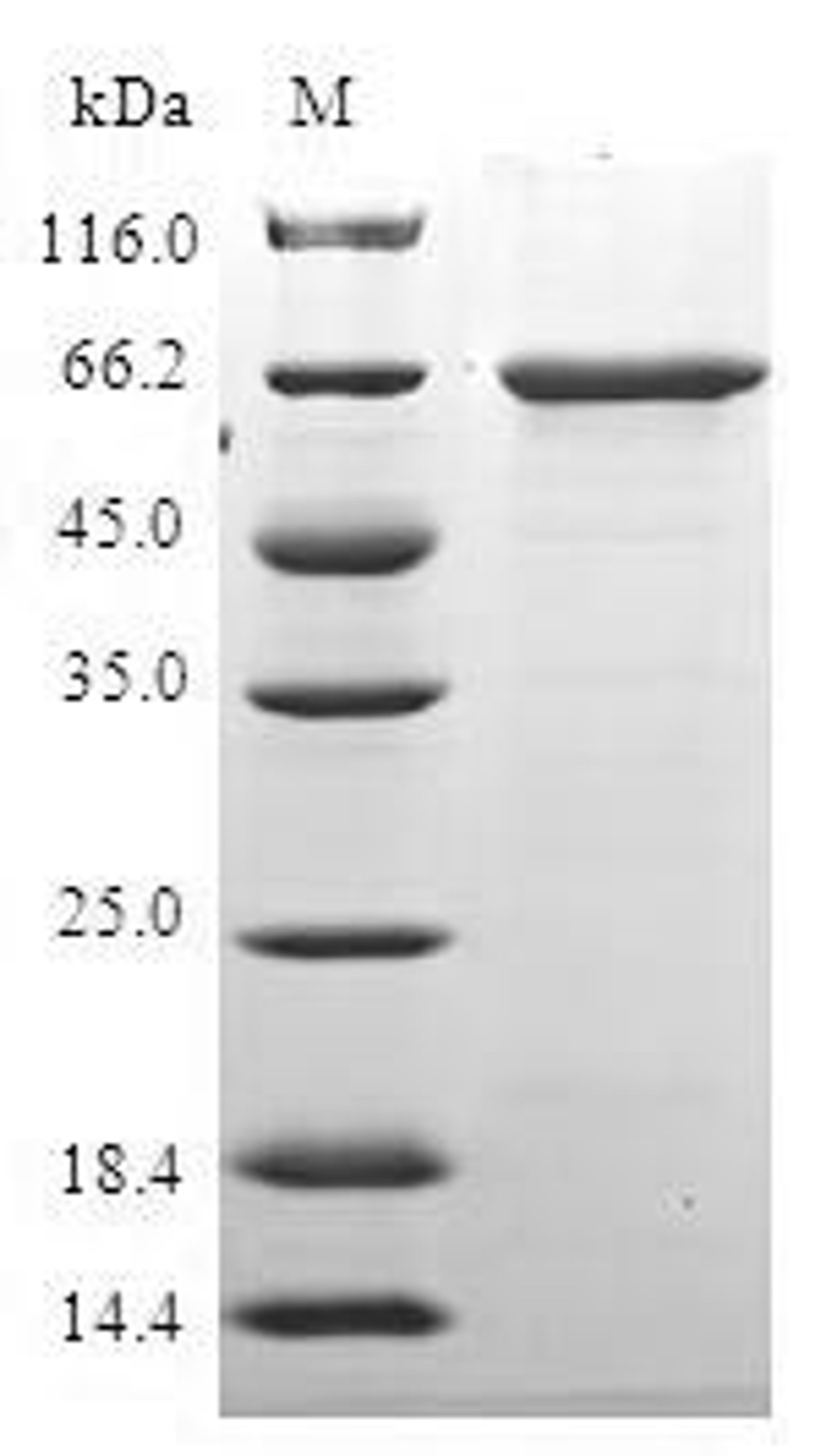 (Tris-Glycine gel) Discontinuous SDS-PAGE (reduced) with 5% enrichment gel and 15% separation gel.