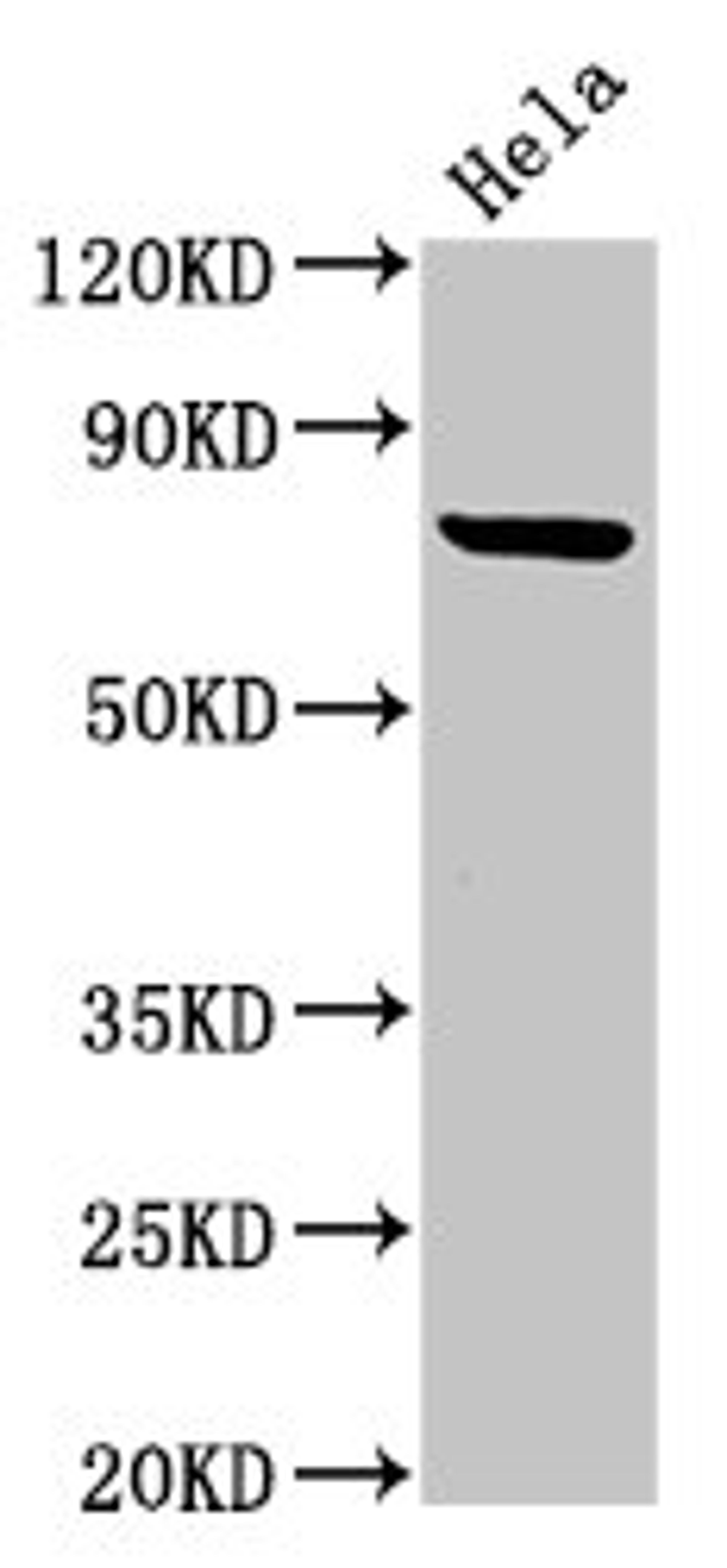 Western Blot. Positive WB detected in: Hela whole cell lysate. All lanes: RNF219 antibody at 4ug/ml. Secondary. Goat polyclonal to rabbit IgG at 1/50000 dilution. Predicted band size: 81 kDa. Observed band size: 81 kDa. 