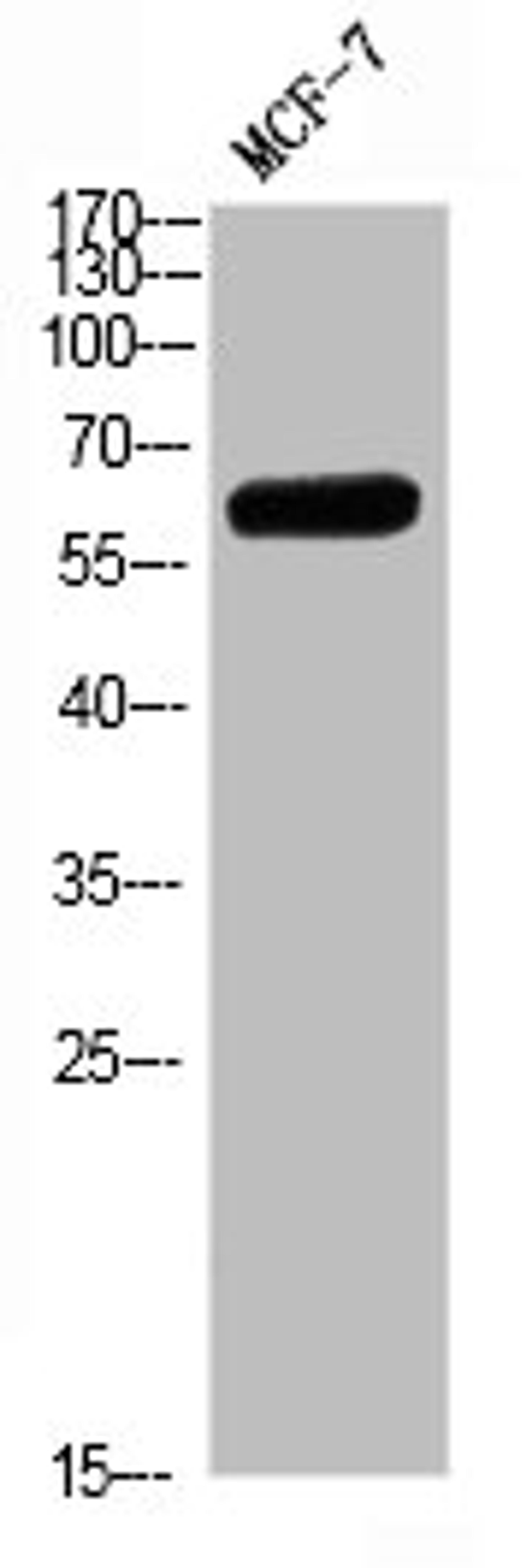 Western blot analysis of MCF7 Cell Lysate, antibody was diluted at 1:1000. Secondary antibody  was diluted at 1:20000
